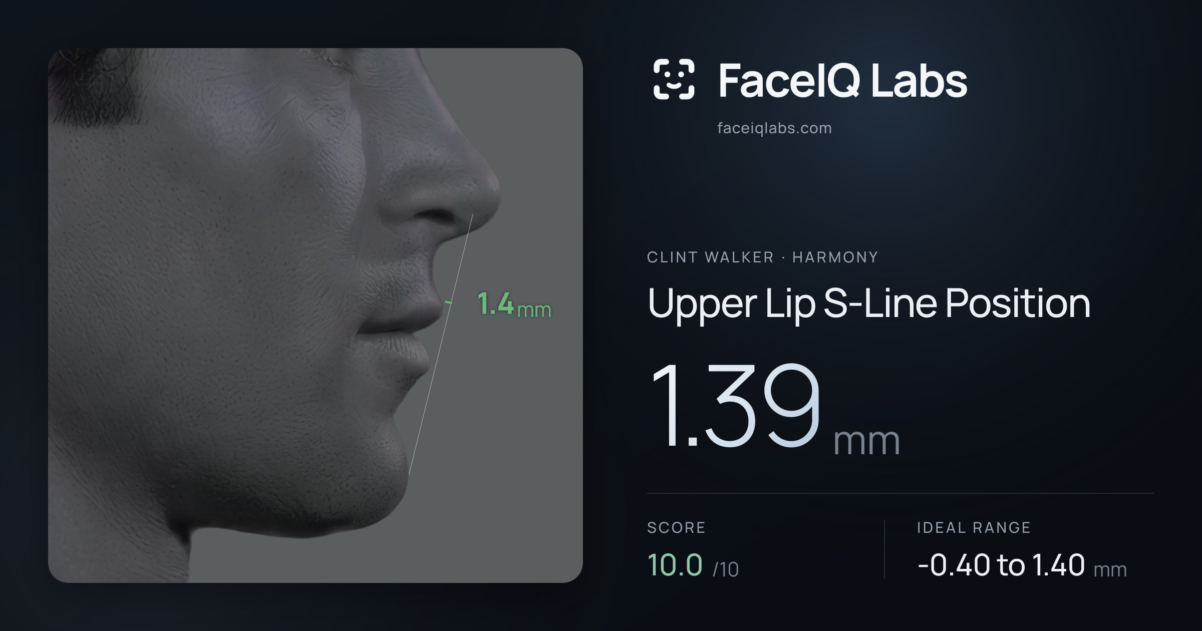 Clint Walker Upper Lip S-Line Position: 1.39mm, drawn on the photo
