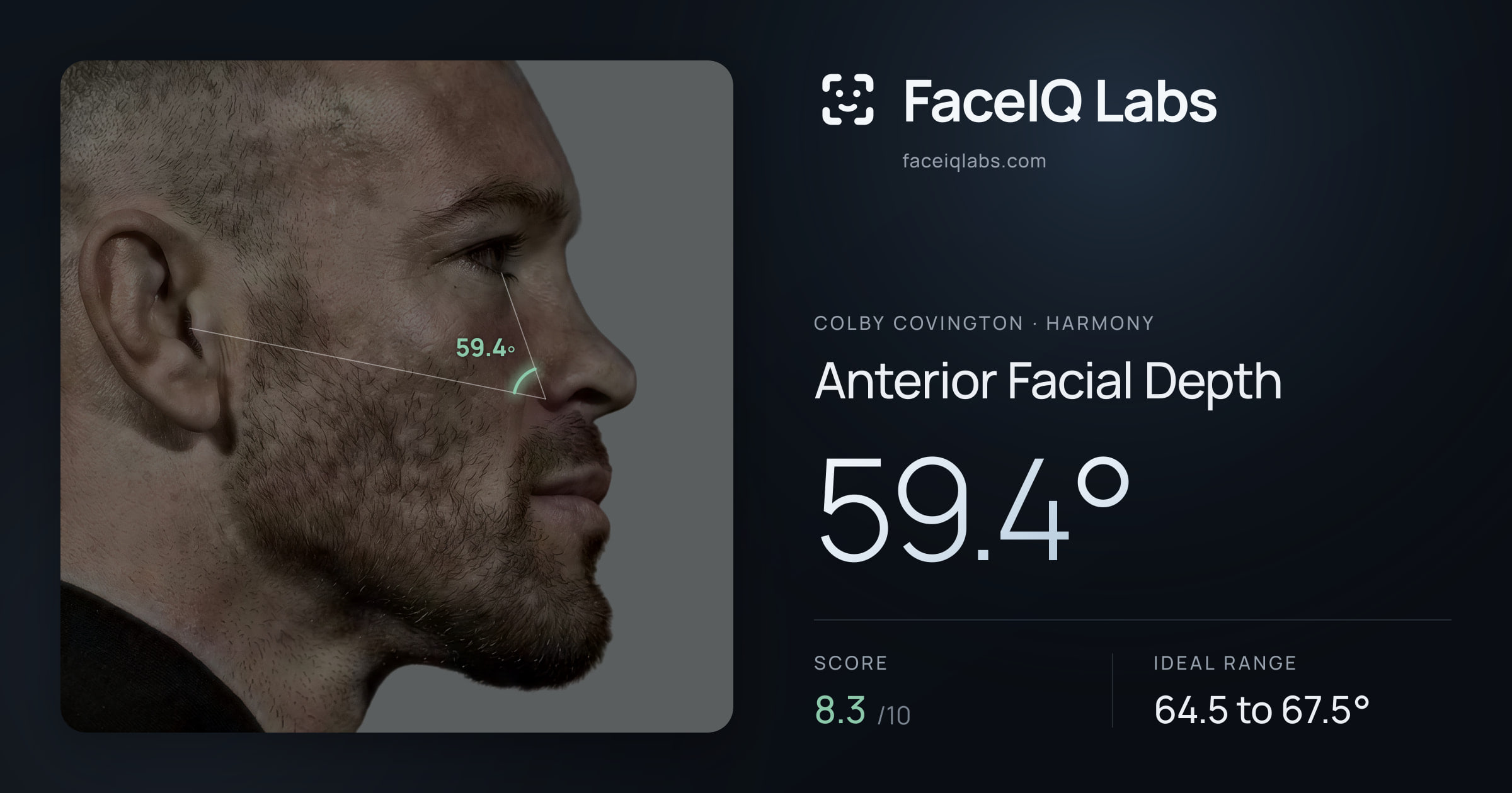 Colby Covington Anterior Facial Depth: 59.4°, drawn on the photo