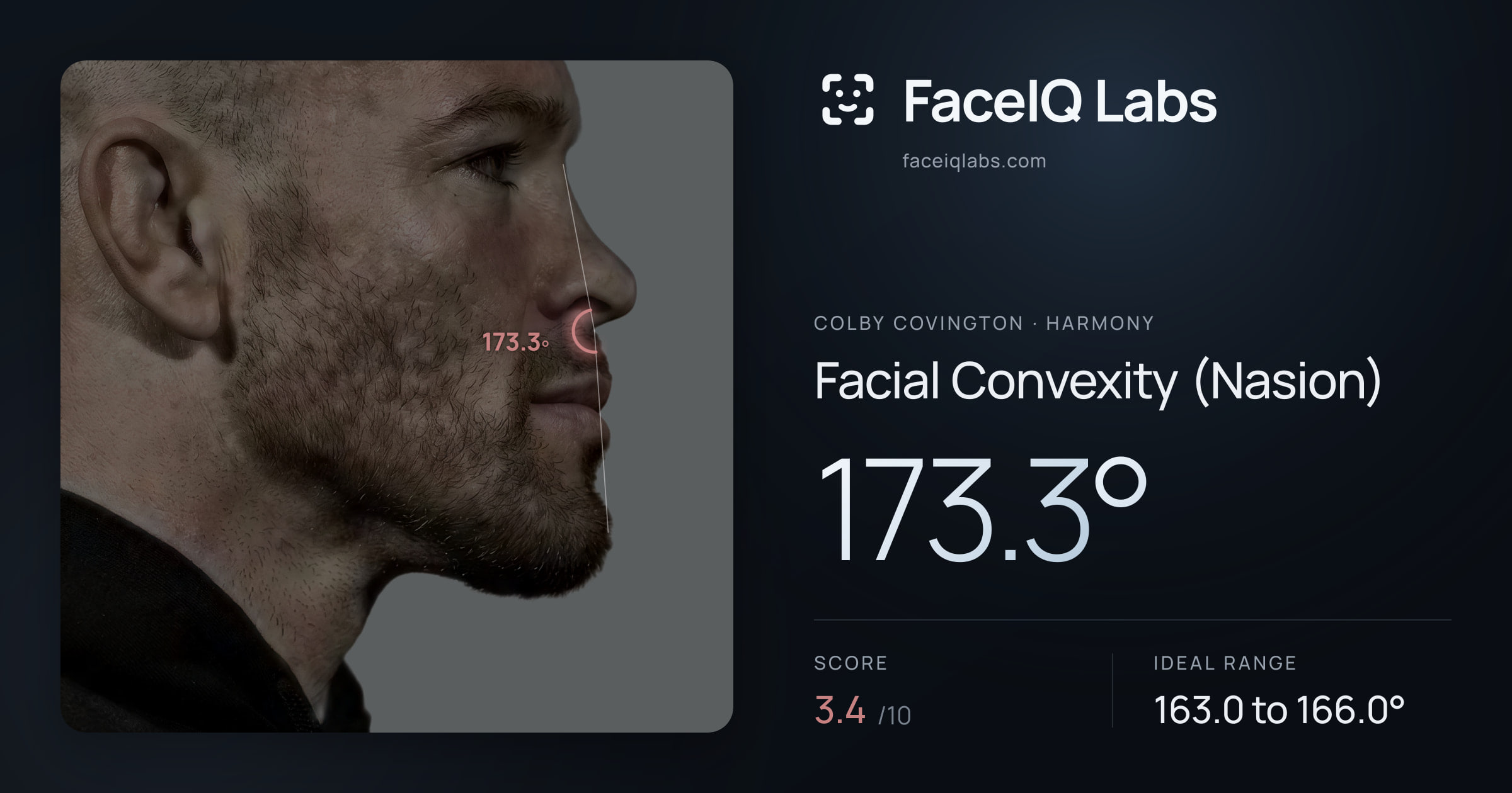 Colby Covington Facial Convexity (Nasion): 173.3°, drawn on the photo