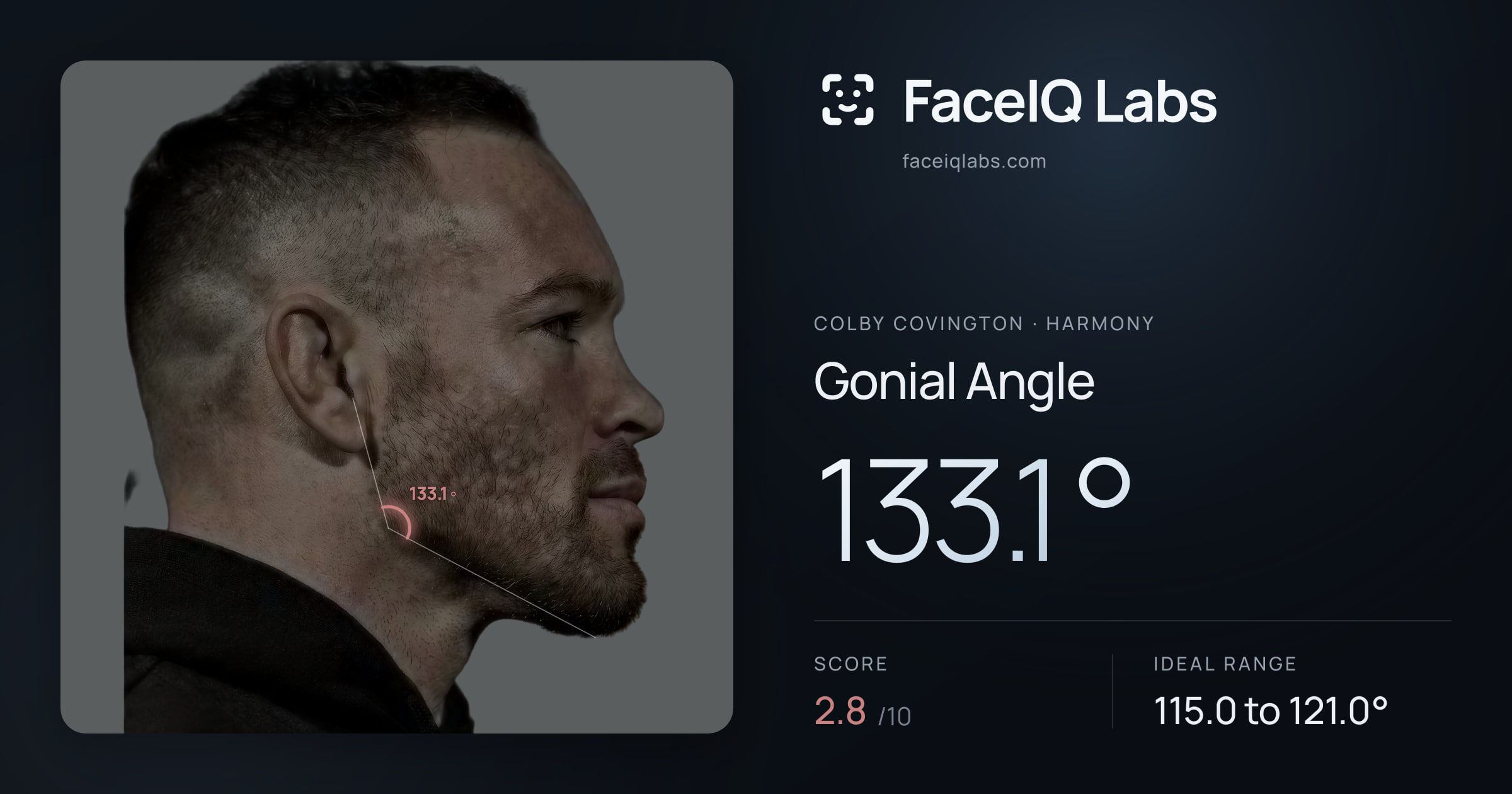 Colby Covington Gonial Angle: 133.1°, drawn on the photo
