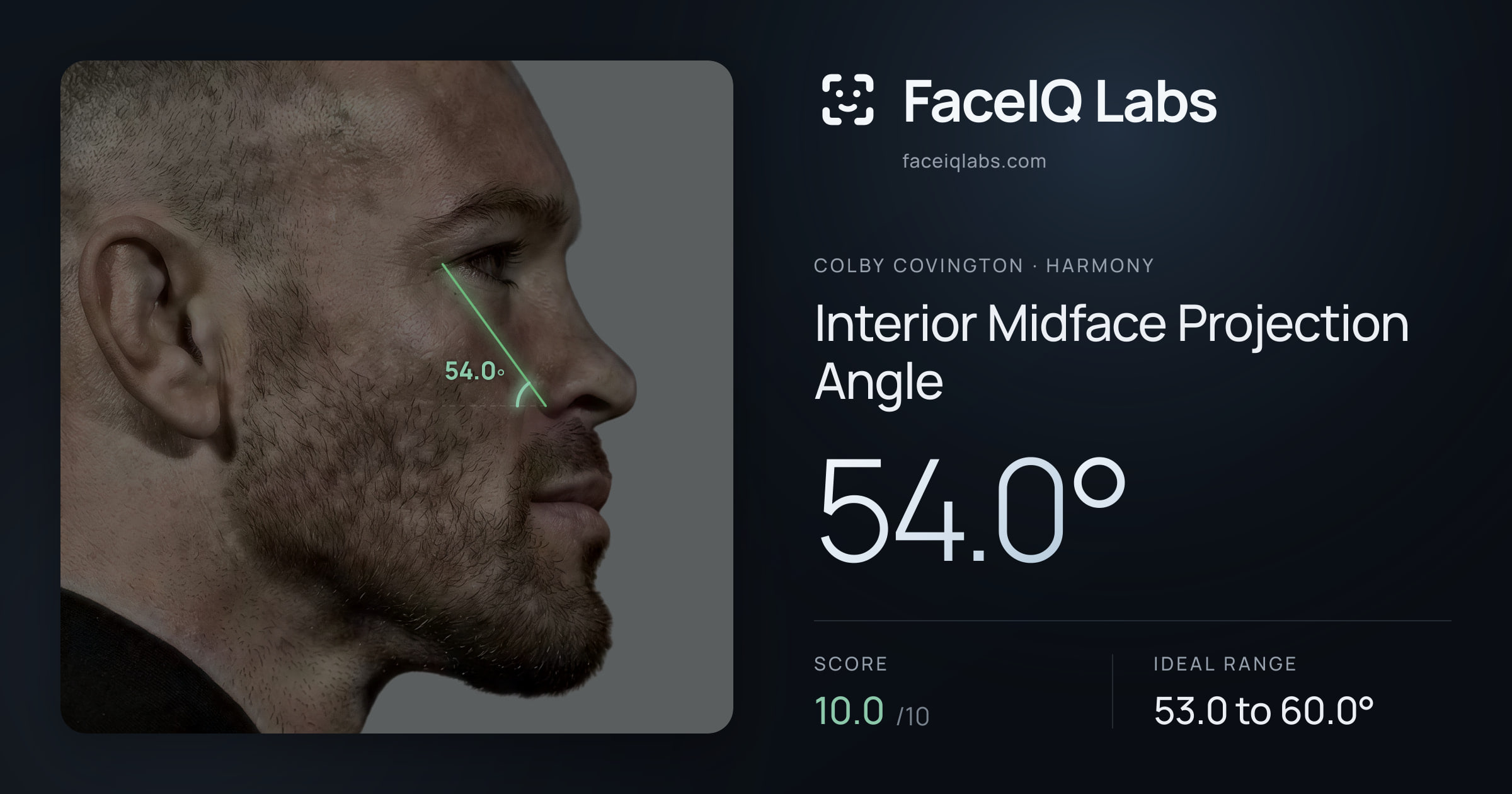 Colby Covington Interior Midface Projection Angle: 54.0°, drawn on the photo