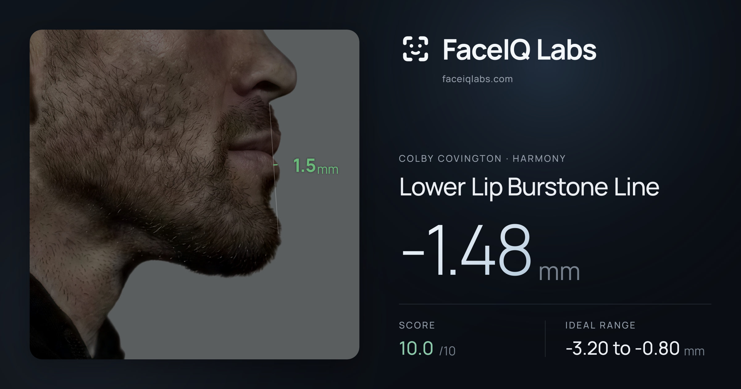 Colby Covington Lower Lip Burstone Line: -1.48mm, drawn on the photo