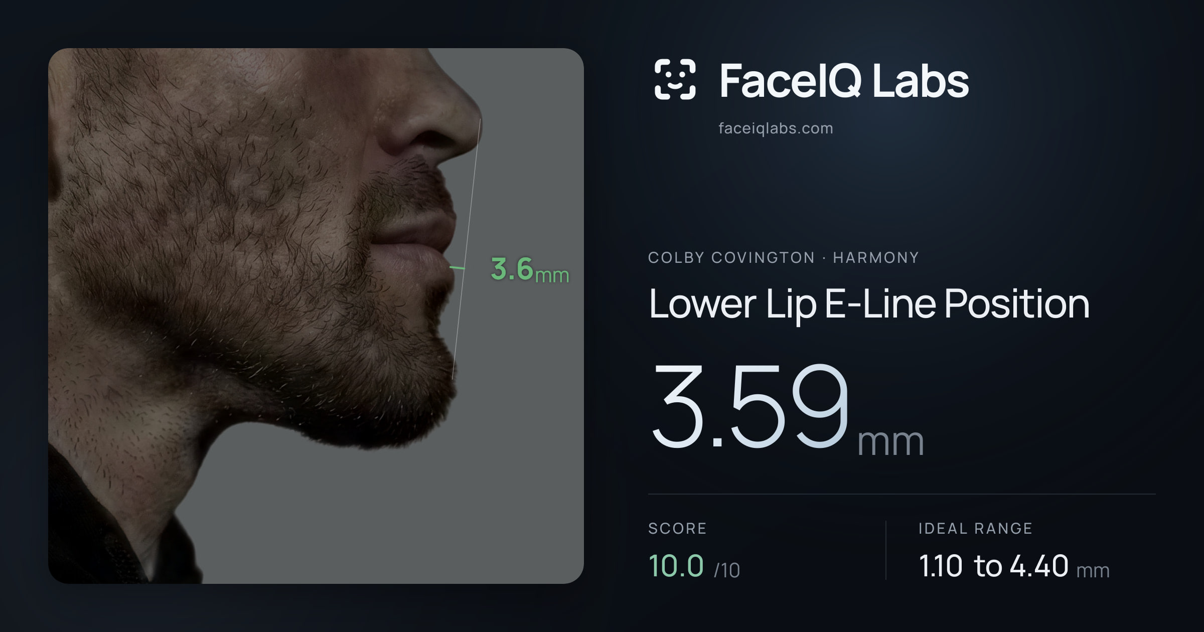 Colby Covington Lower Lip E-Line Position: 3.59mm, drawn on the photo