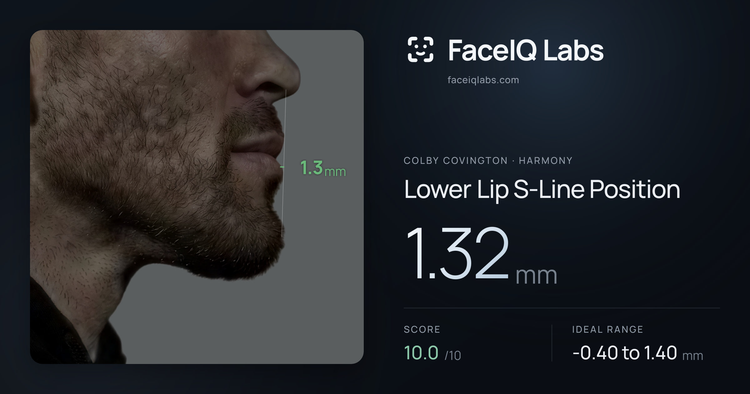 Colby Covington Lower Lip S-Line Position: 1.32mm, drawn on the photo