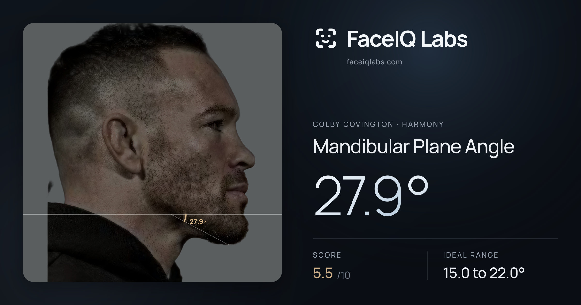 Colby Covington Mandibular Plane Angle: 27.9°, drawn on the photo