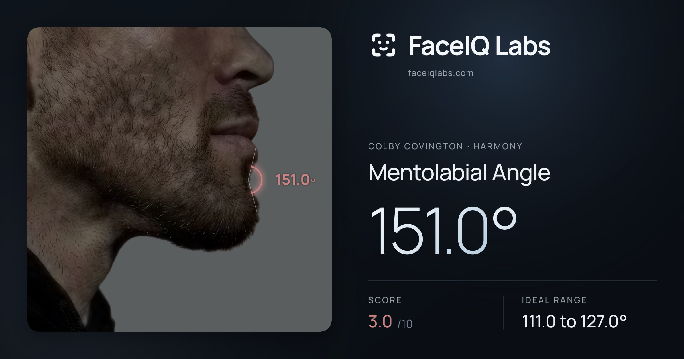 Colby Covington Mentolabial Angle: 151.0°, drawn on the photo