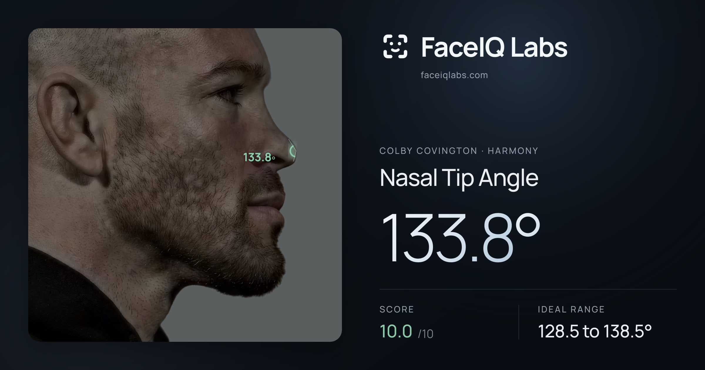 Colby Covington Nasal Tip Angle: 133.8°, drawn on the photo
