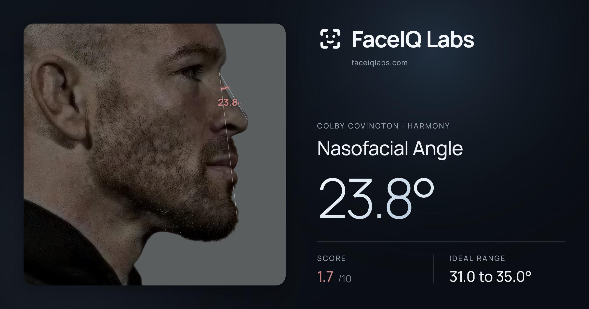 Colby Covington Nasofacial Angle: 23.8°, drawn on the photo