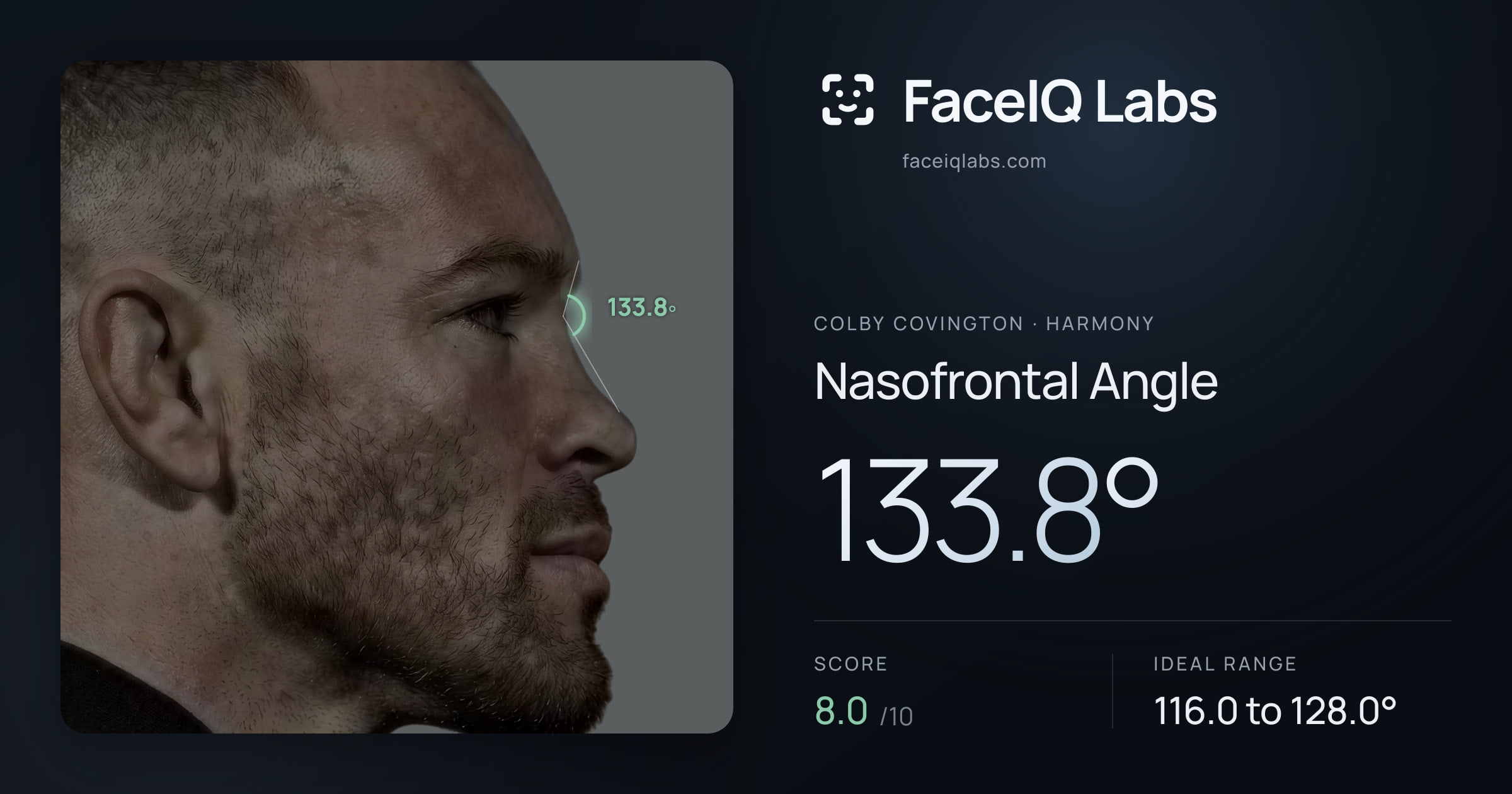 Colby Covington Nasofrontal Angle: 133.8°, drawn on the photo