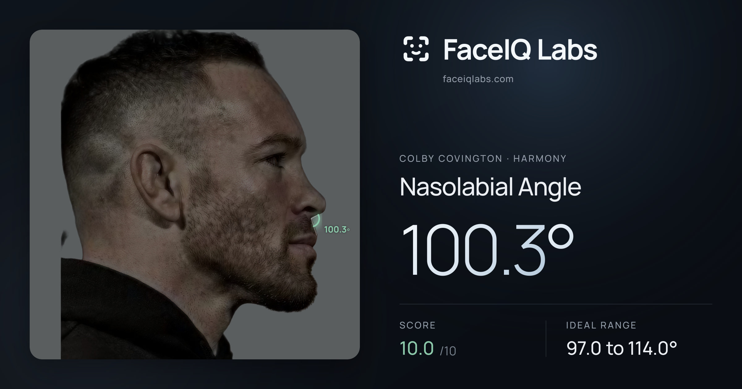 Colby Covington Nasolabial Angle: 100.3°, drawn on the photo