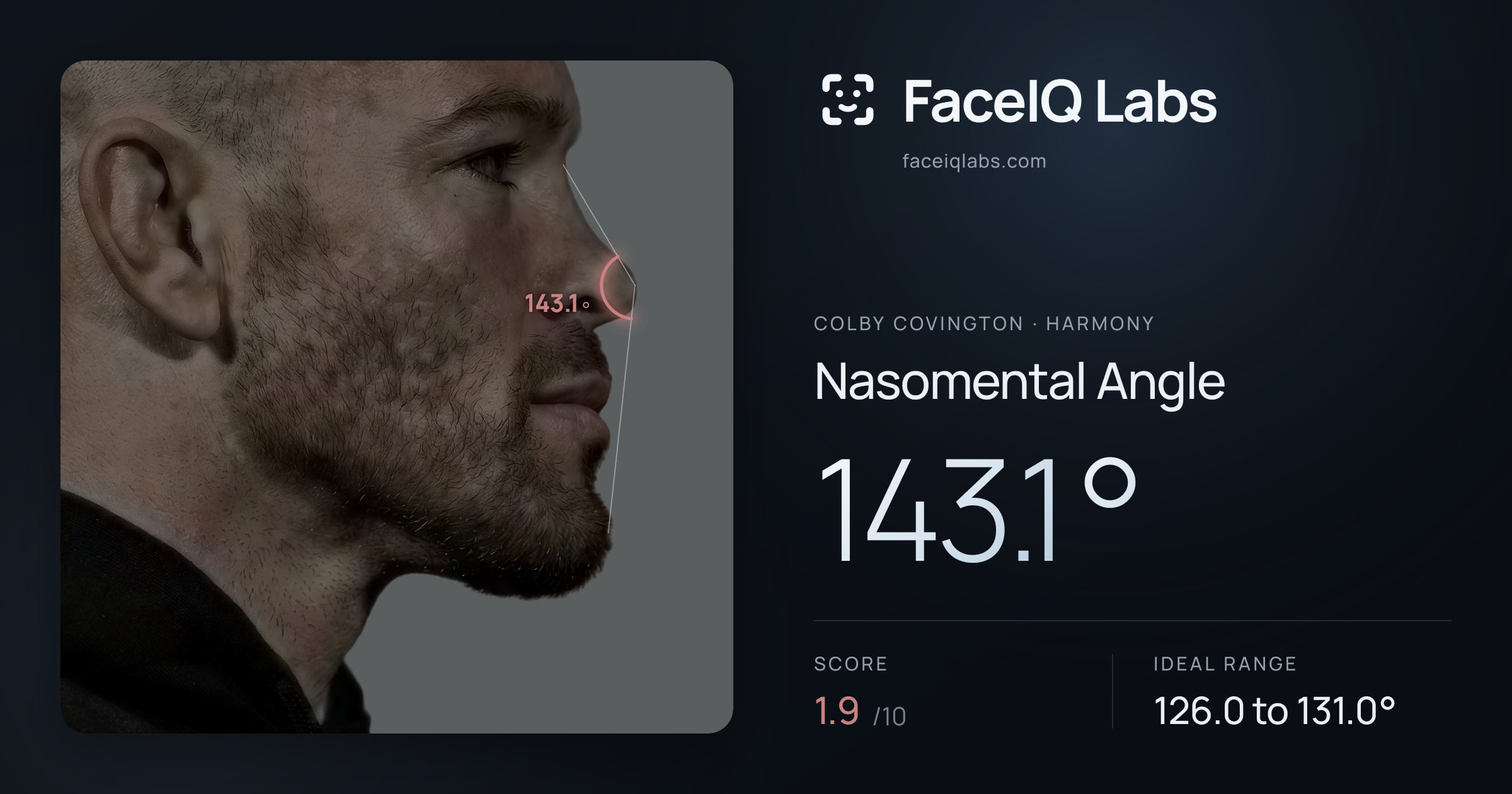 Colby Covington Nasomental Angle: 143.1°, drawn on the photo