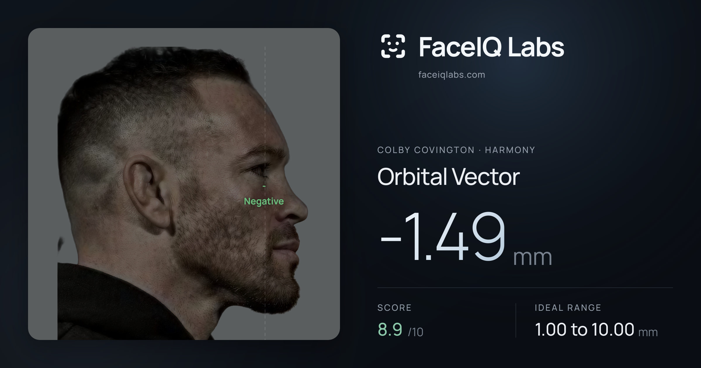 Colby Covington Orbital Vector: -1.49mm, drawn on the photo
