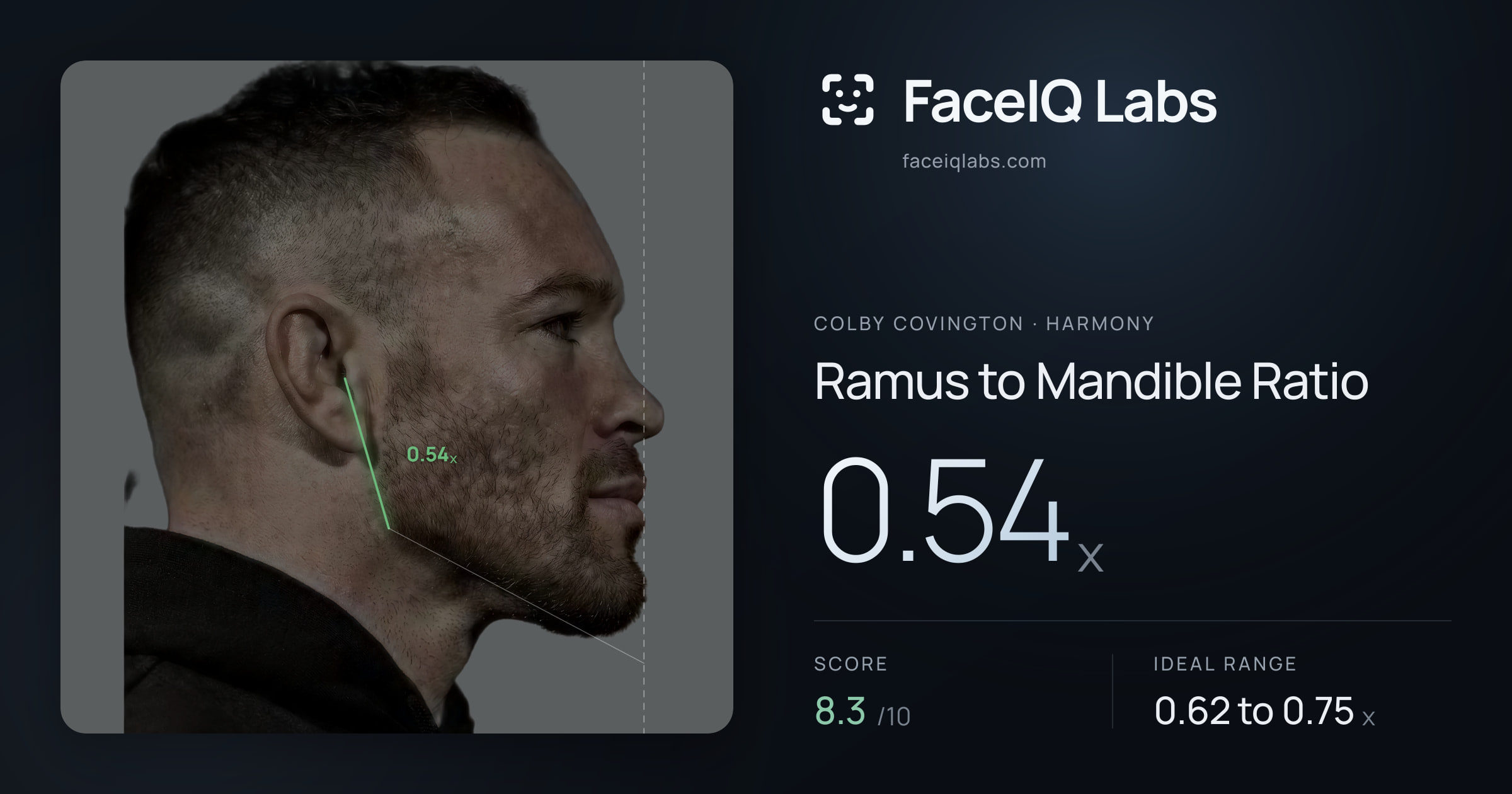 Colby Covington Ramus to Mandible Ratio: 0.54x, drawn on the photo