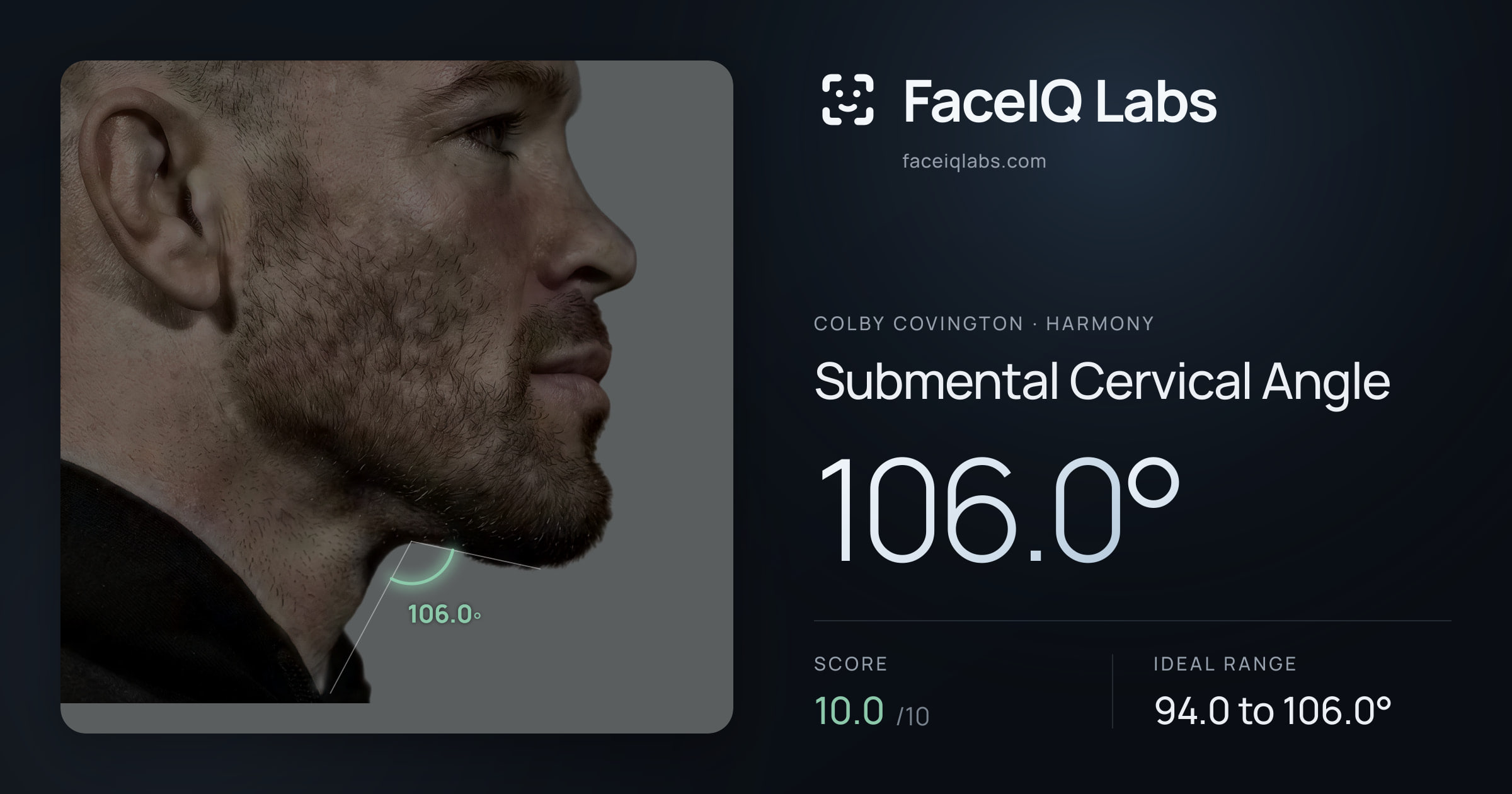 Colby Covington Submental Cervical Angle: 106.0°, drawn on the photo