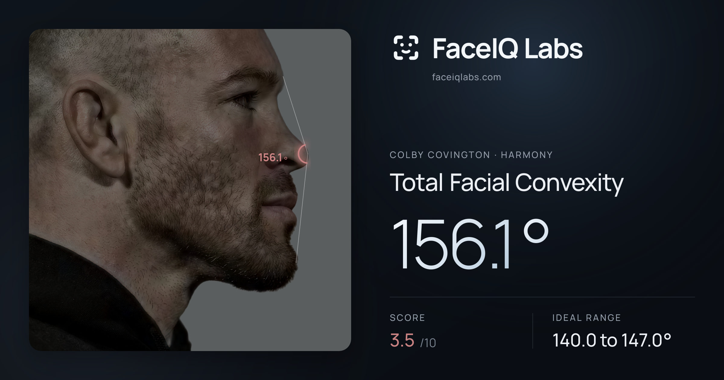 Colby Covington Total Facial Convexity: 156.1°, drawn on the photo