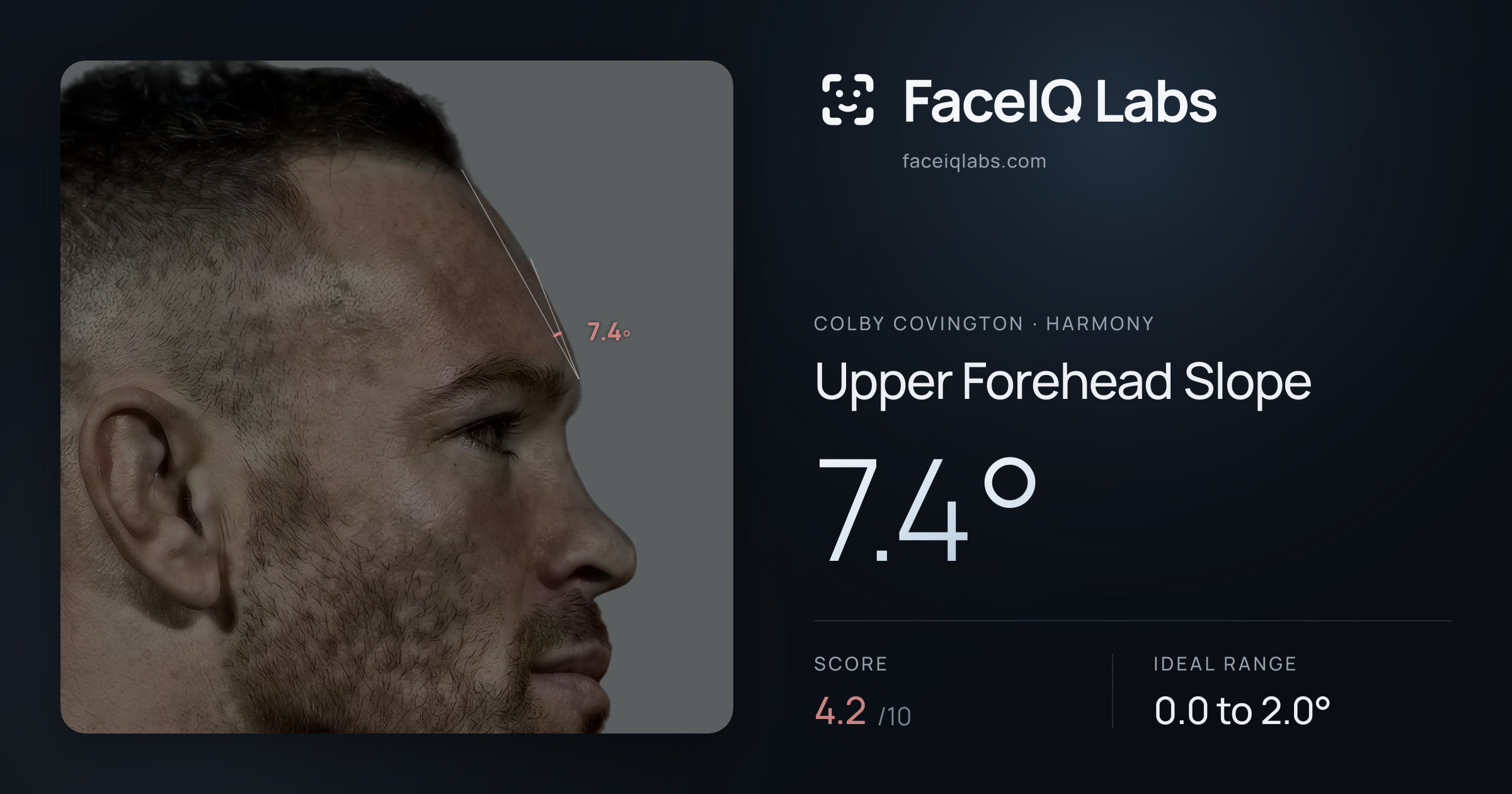 Colby Covington Upper Forehead Slope: 7.4°, drawn on the photo