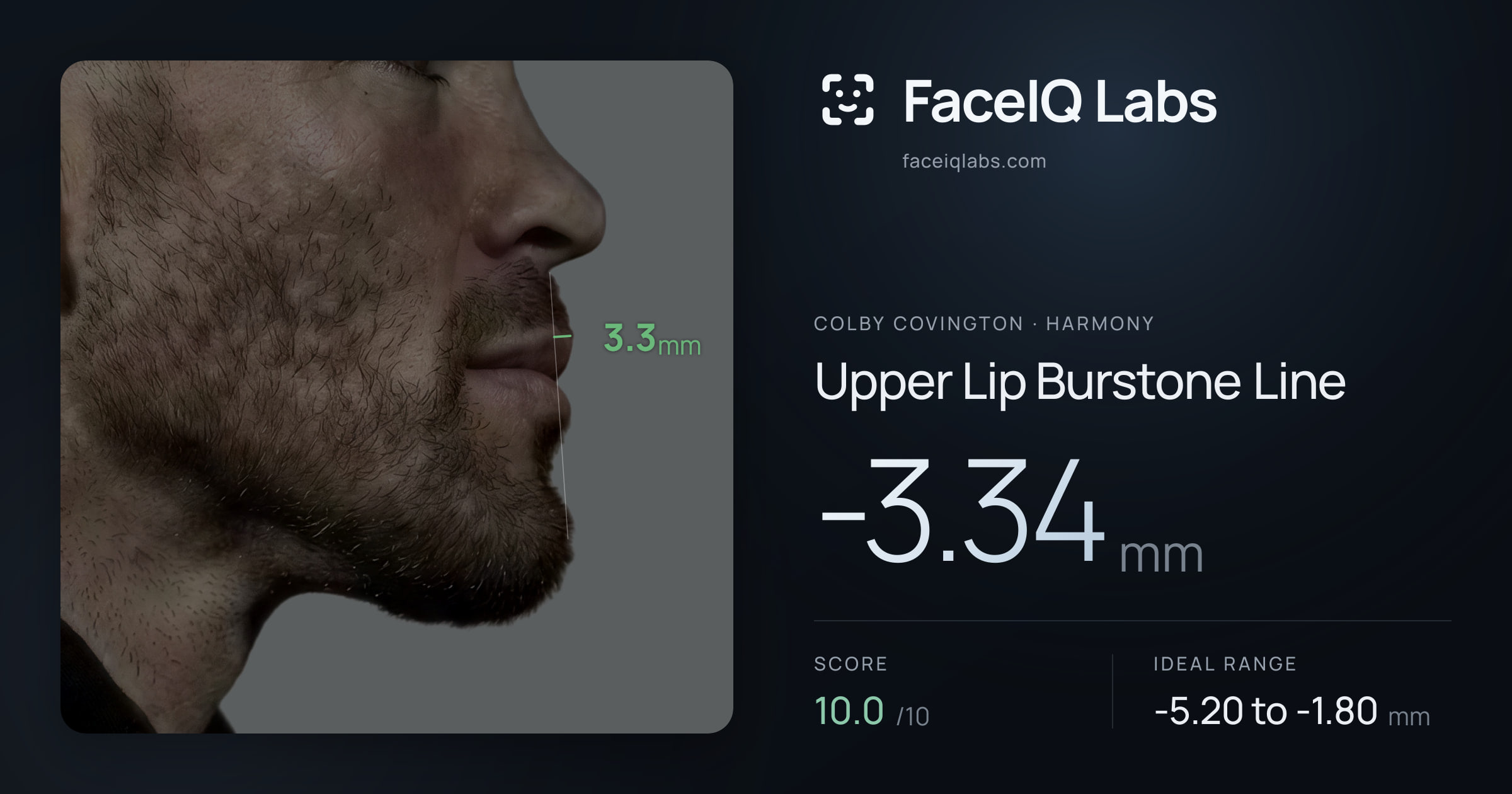 Colby Covington Upper Lip Burstone Line: -3.34mm, drawn on the photo