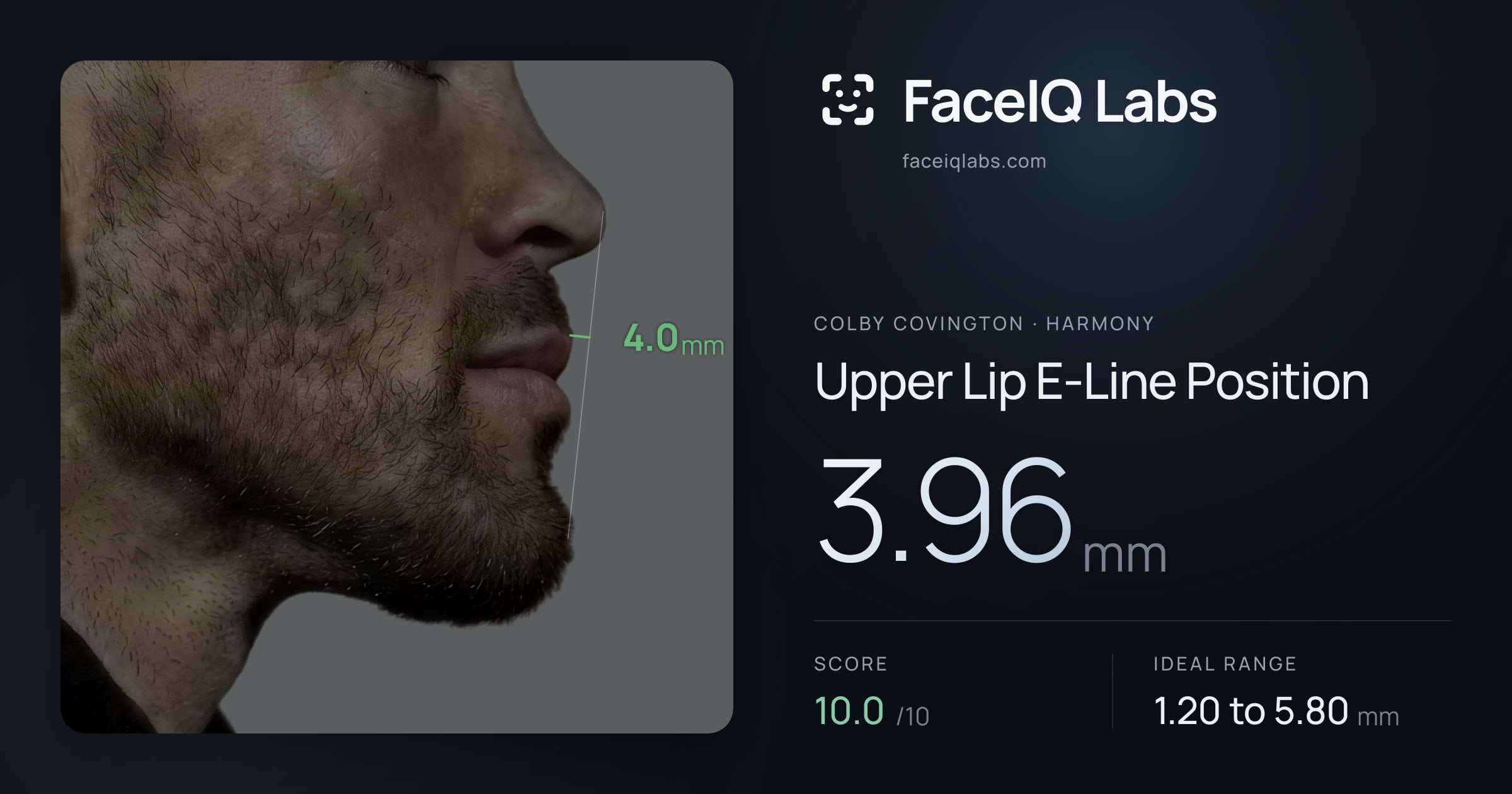 Colby Covington Upper Lip E-Line Position: 3.96mm, drawn on the photo