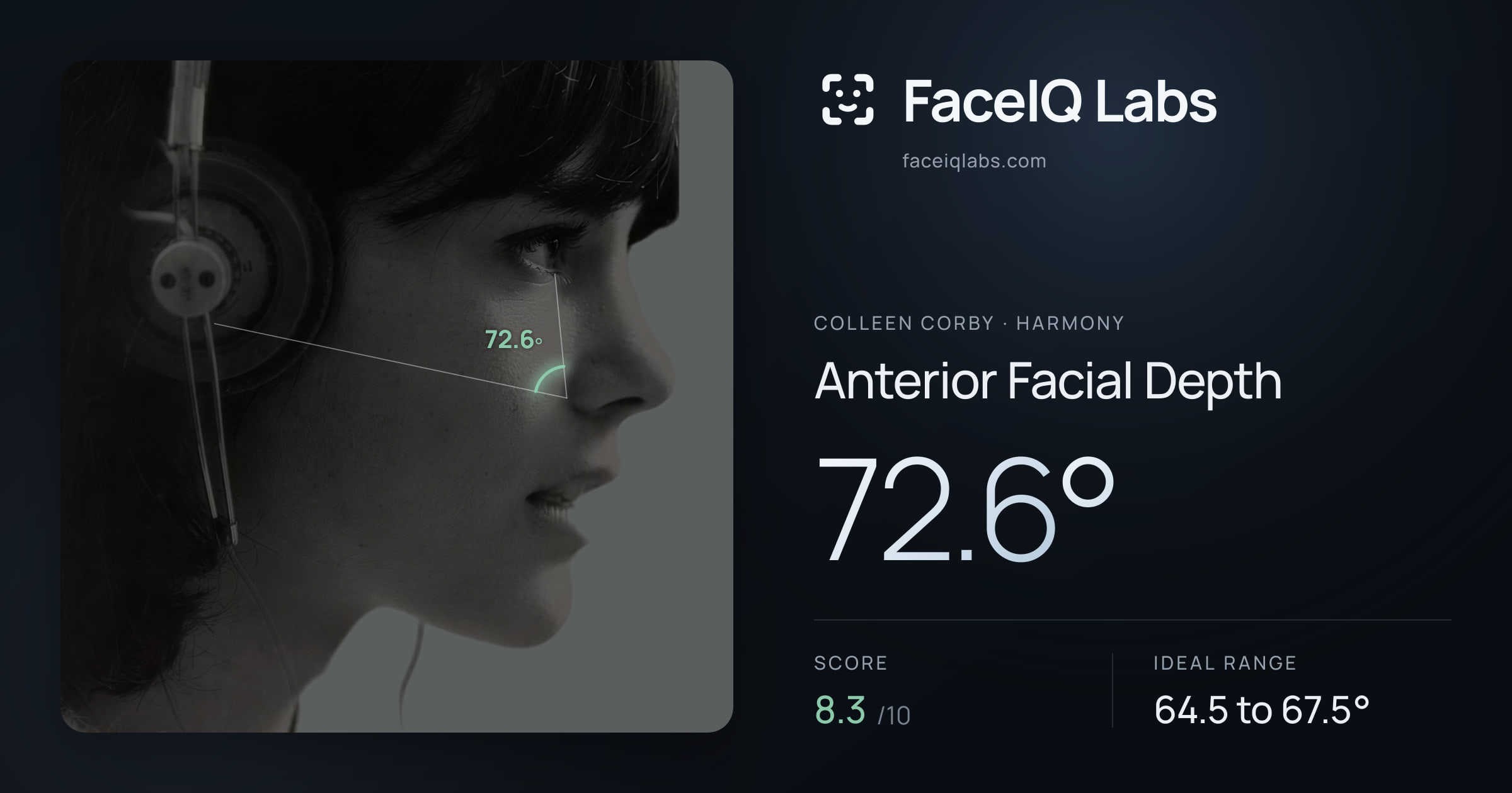 Colleen Corby Anterior Facial Depth: 72.6°, drawn on the photo
