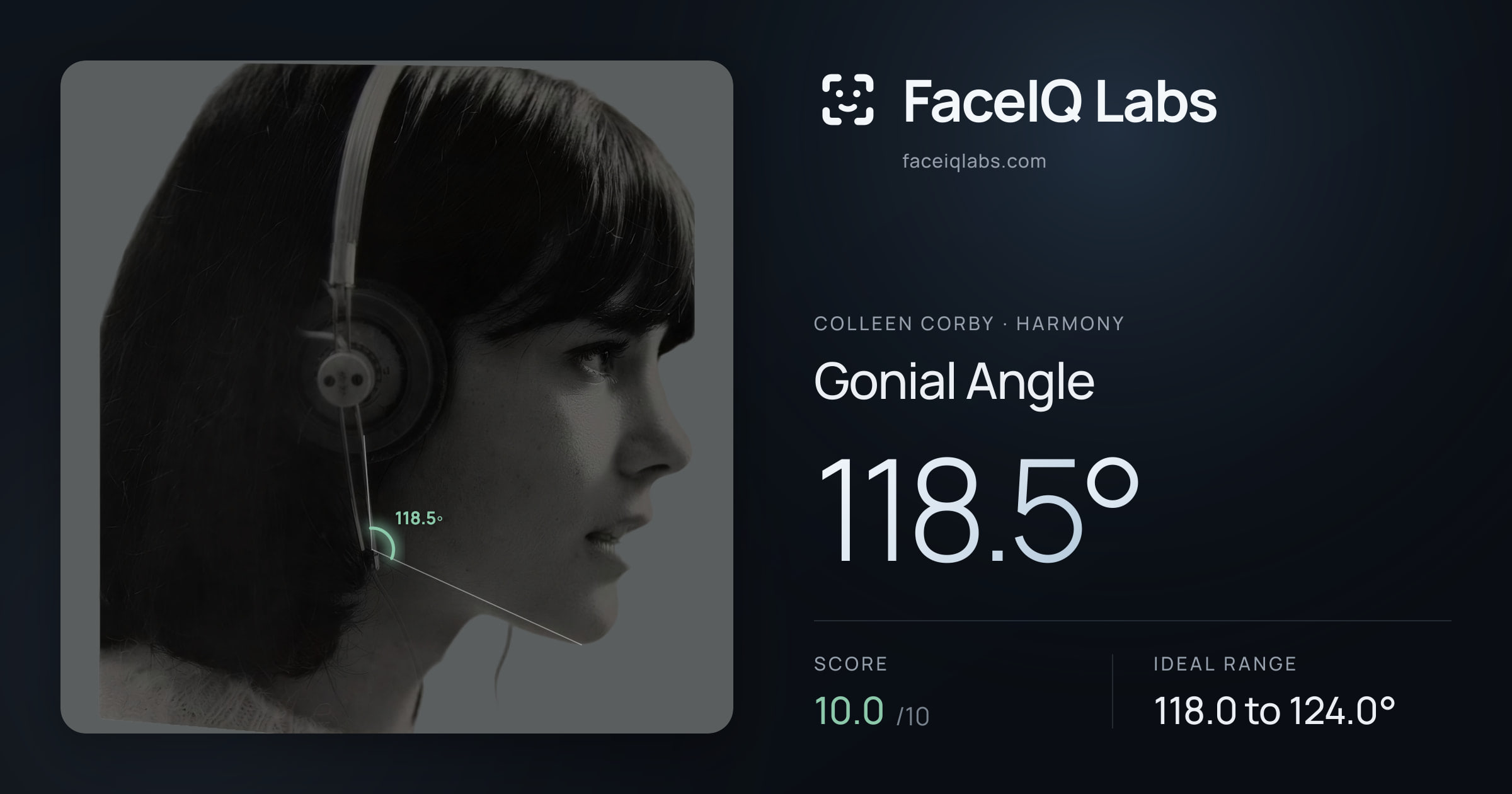 Colleen Corby Gonial Angle: 118.5°, drawn on the photo