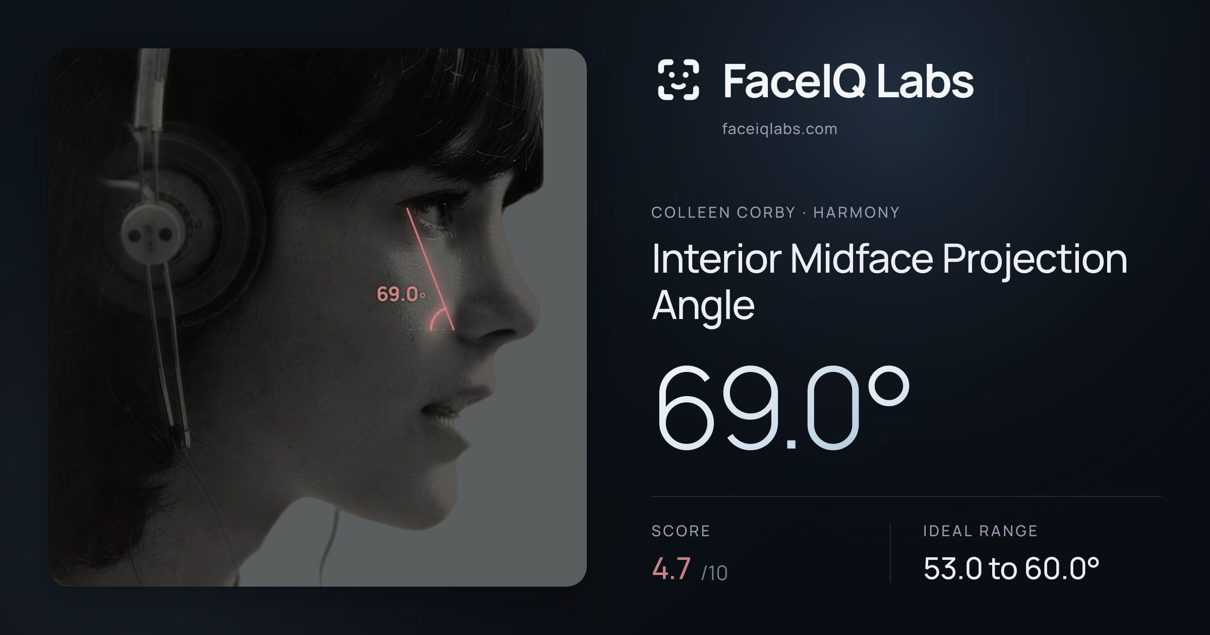 Colleen Corby Interior Midface Projection Angle: 69.0°, drawn on the photo