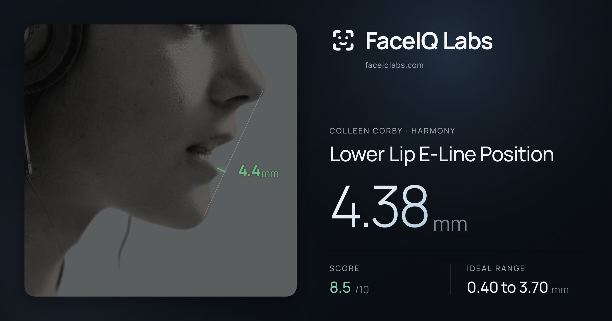 Colleen Corby Lower Lip E-Line Position: 4.38mm, drawn on the photo