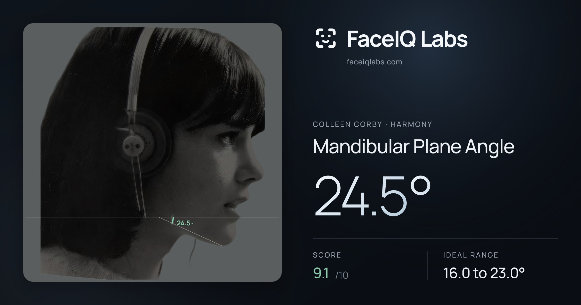 Colleen Corby Mandibular Plane Angle: 24.5°, drawn on the photo