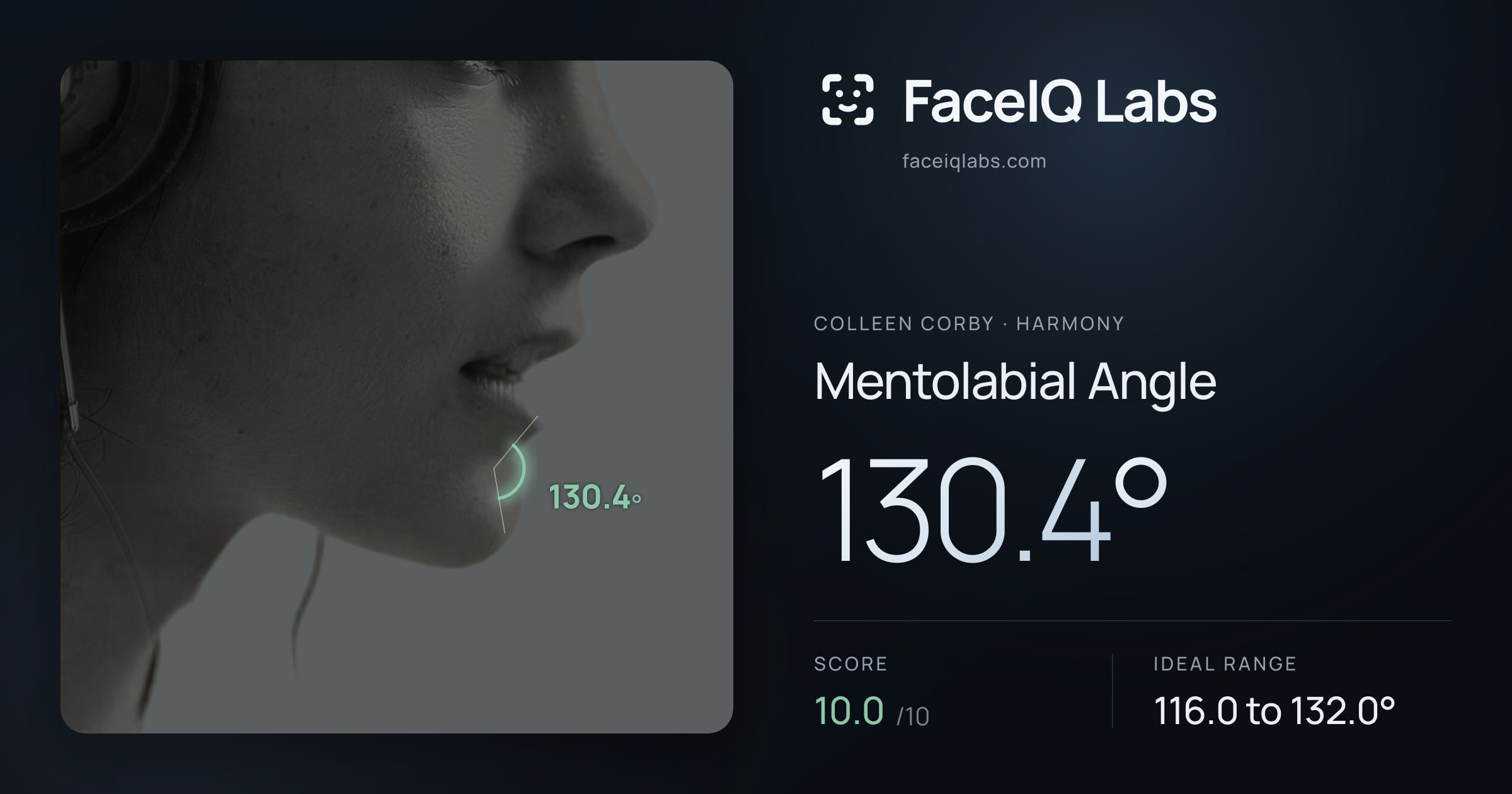 Colleen Corby Mentolabial Angle: 130.4°, drawn on the photo