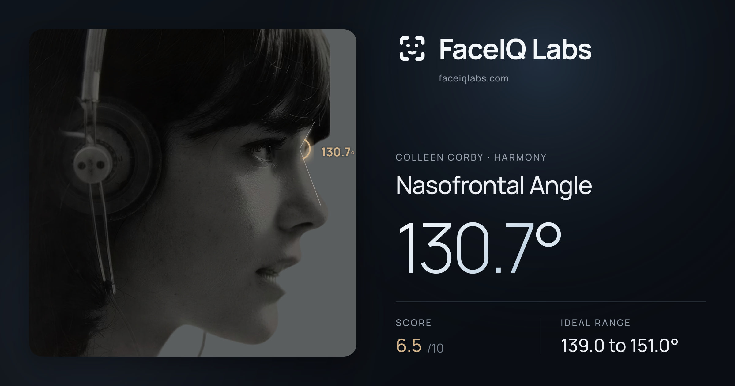 Colleen Corby Nasofrontal Angle: 130.7°, drawn on the photo