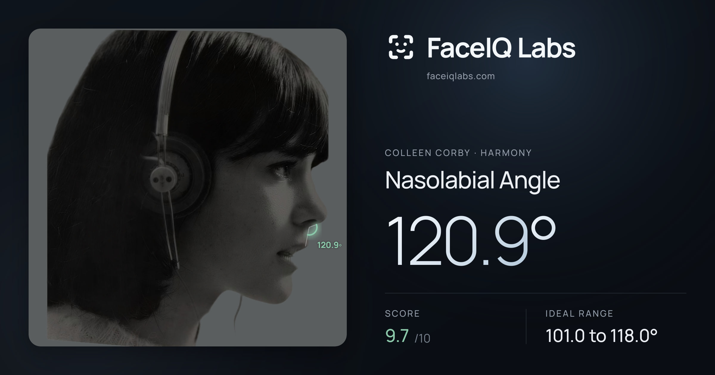Colleen Corby Nasolabial Angle: 120.9°, drawn on the photo