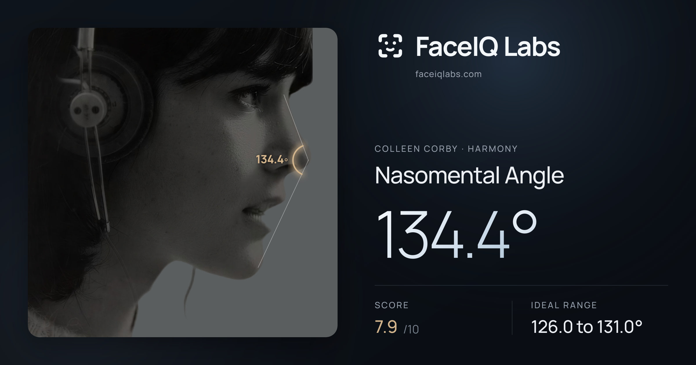 Colleen Corby Nasomental Angle: 134.4°, drawn on the photo