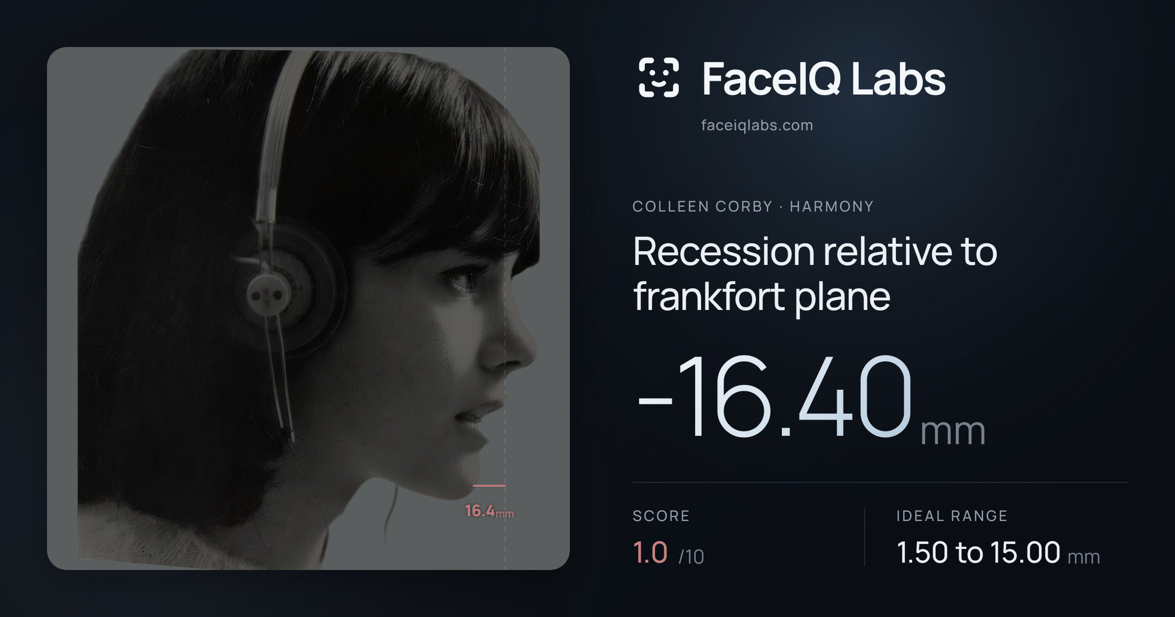 Colleen Corby Recession relative to frankfort plane: -16.40mm, drawn on the photo