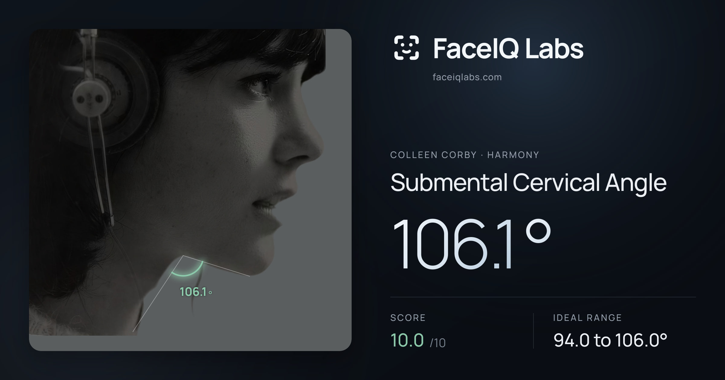 Colleen Corby Submental Cervical Angle: 106.1°, drawn on the photo