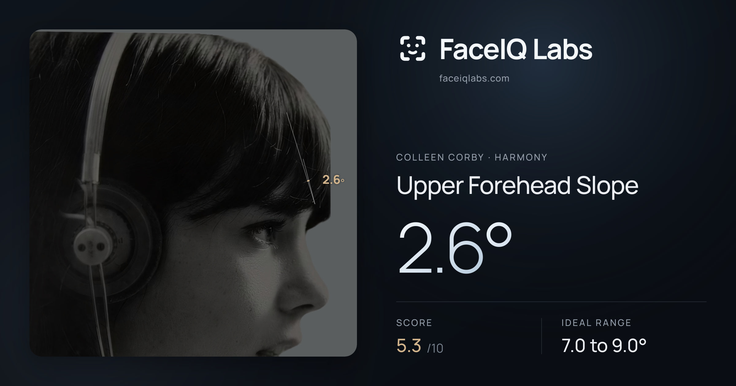 Colleen Corby Upper Forehead Slope: 2.6°, drawn on the photo