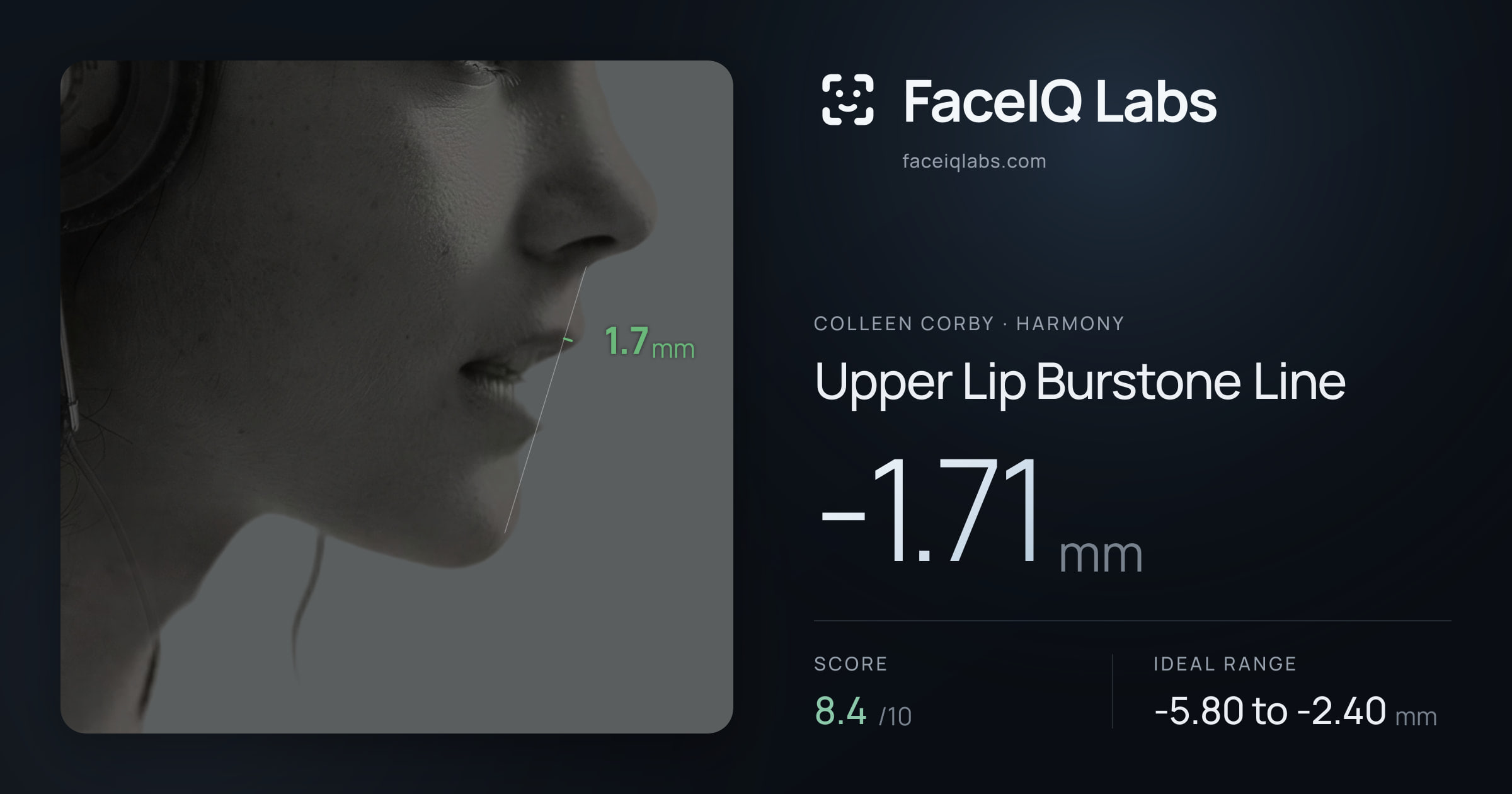 Colleen Corby Upper Lip Burstone Line: -1.71mm, drawn on the photo