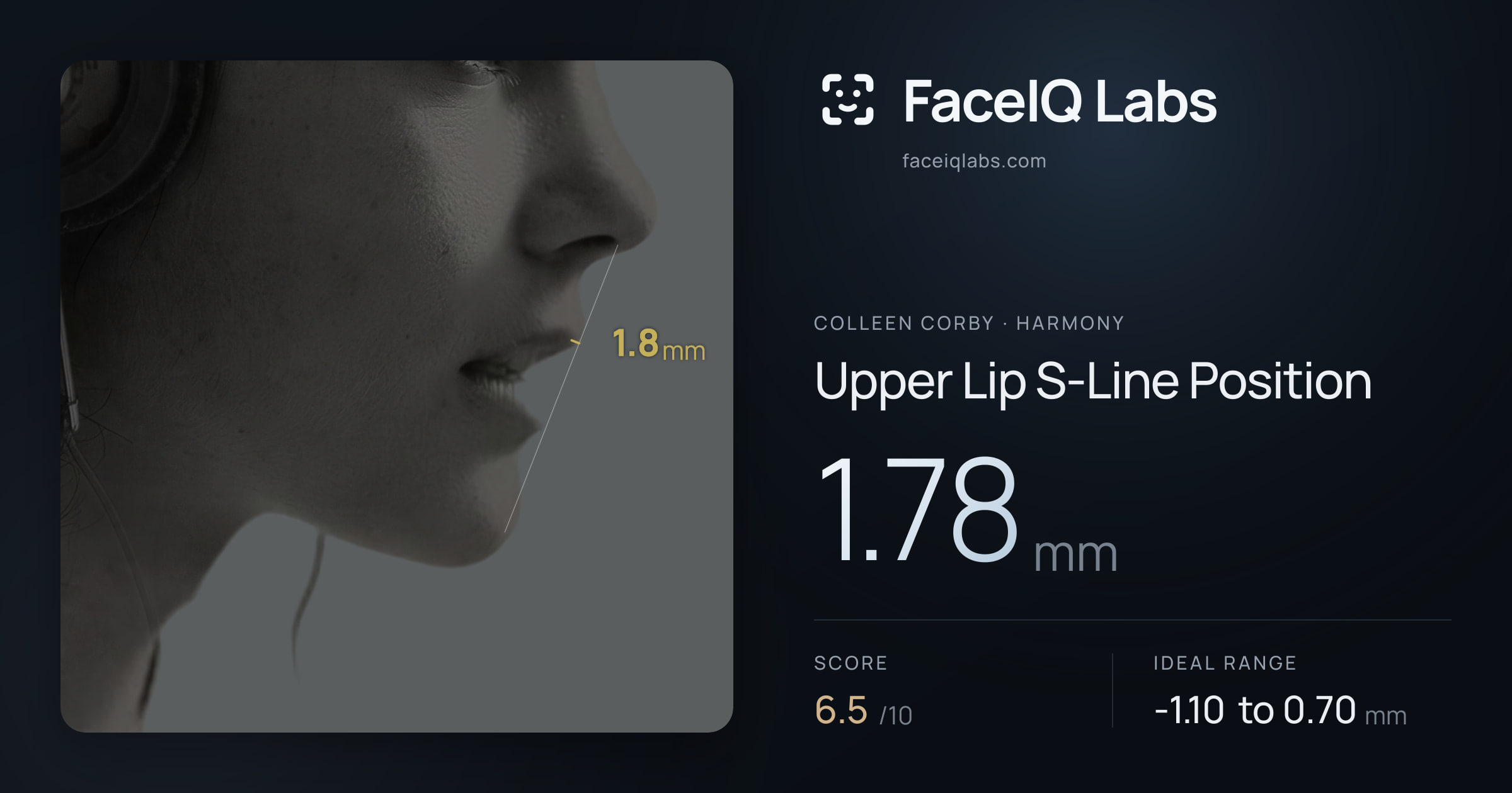 Colleen Corby Upper Lip S-Line Position: 1.78mm, drawn on the photo