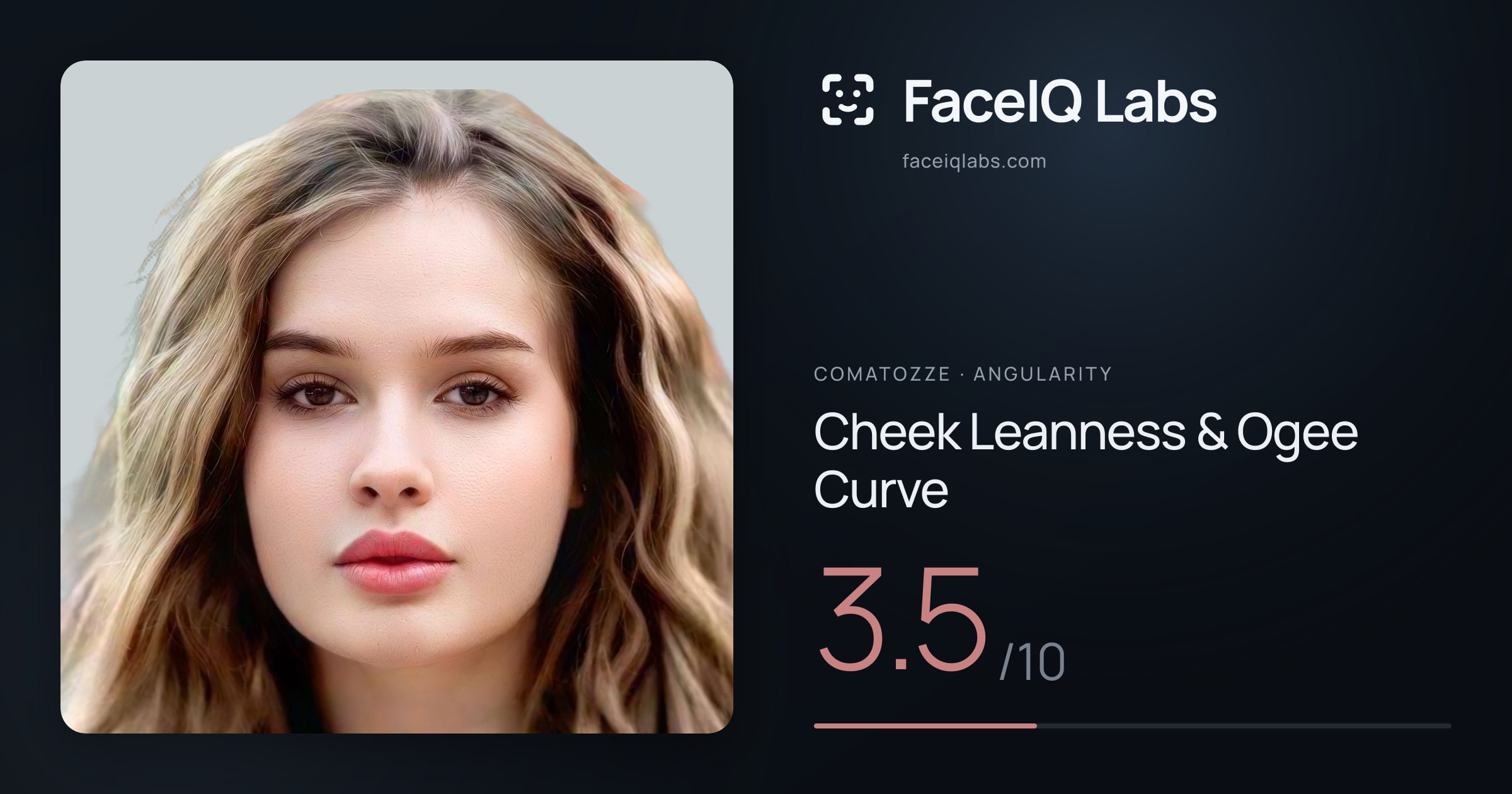 comatozze Cheek Leanness & Ogee Curve: 3.5/10, drawn on the photo