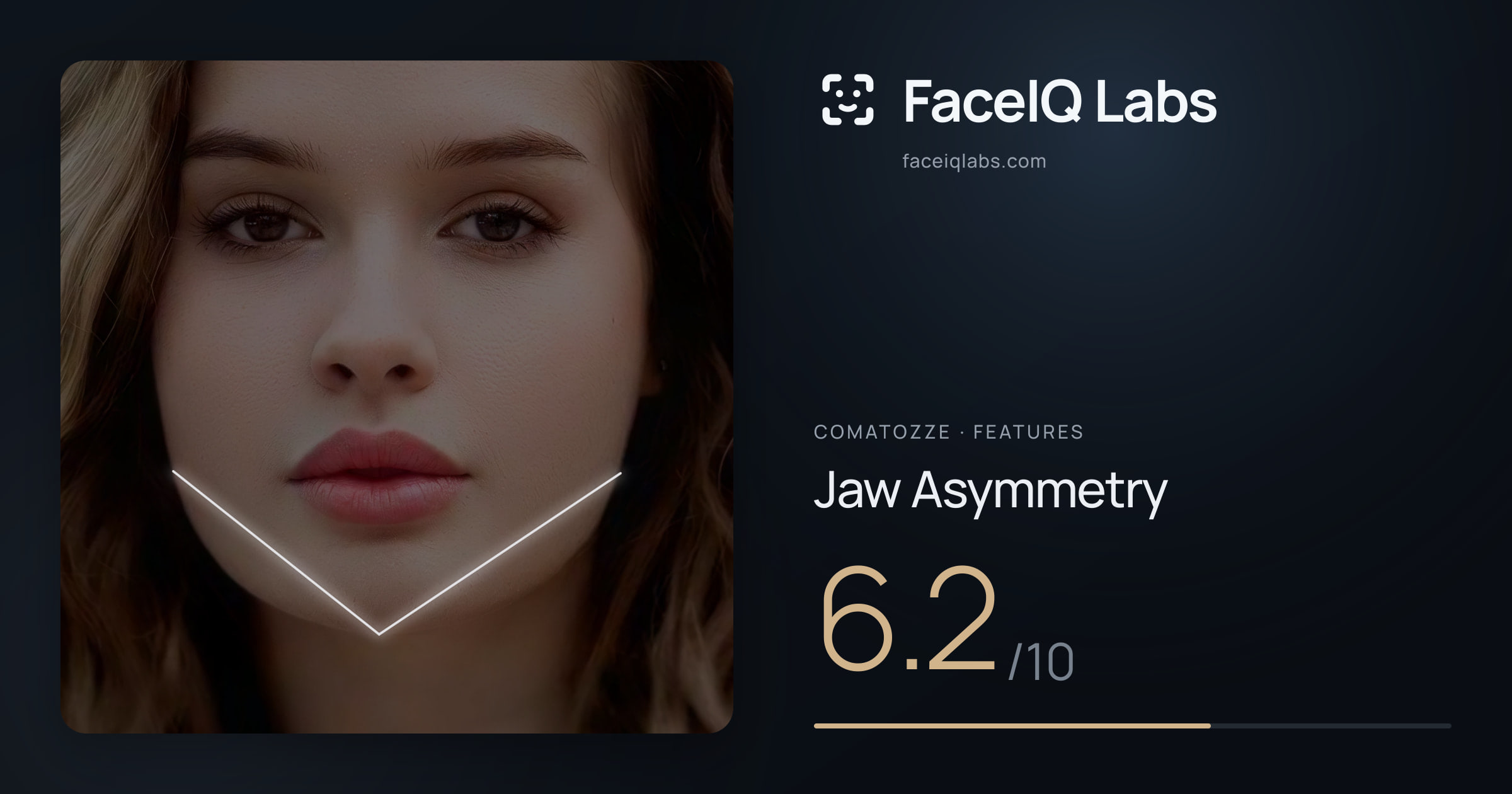 comatozze Jaw Asymmetry: 6.2/10, drawn on the photo
