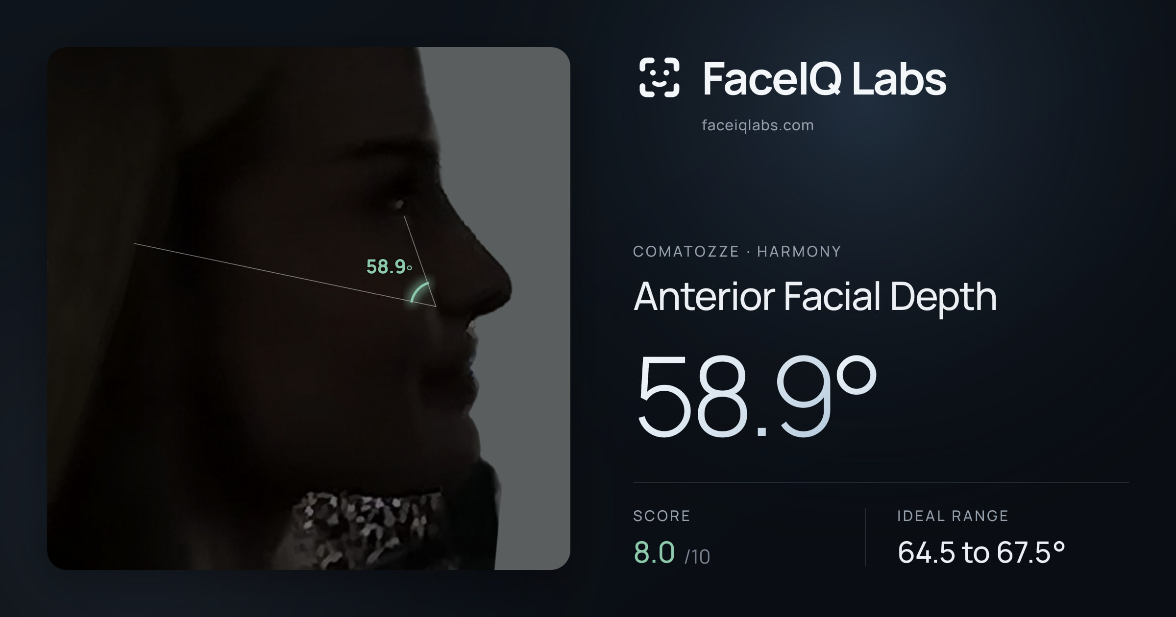 comatozze Anterior Facial Depth: 58.9°, drawn on the photo