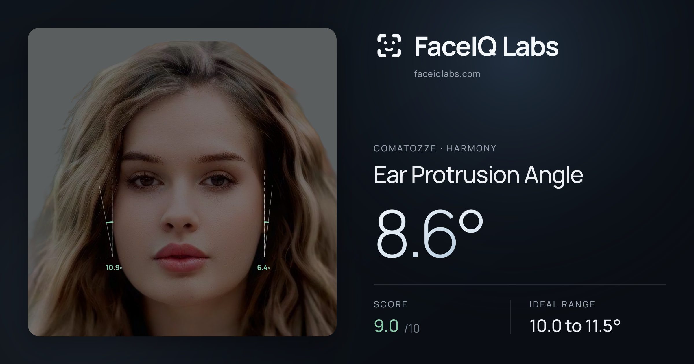 comatozze Ear Protrusion Angle: 8.6°, drawn on the photo