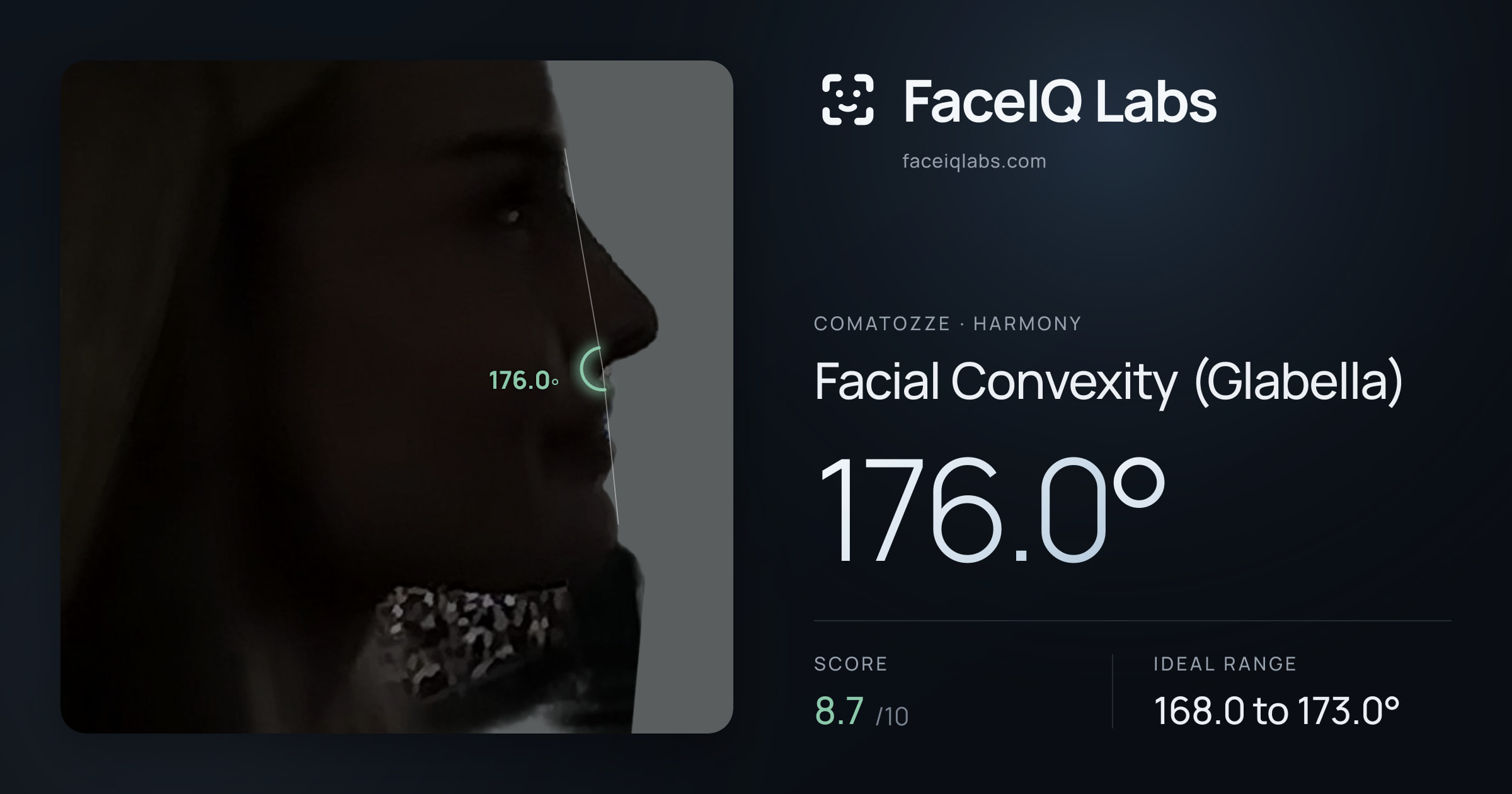 comatozze Facial Convexity (Glabella): 176.0°, drawn on the photo