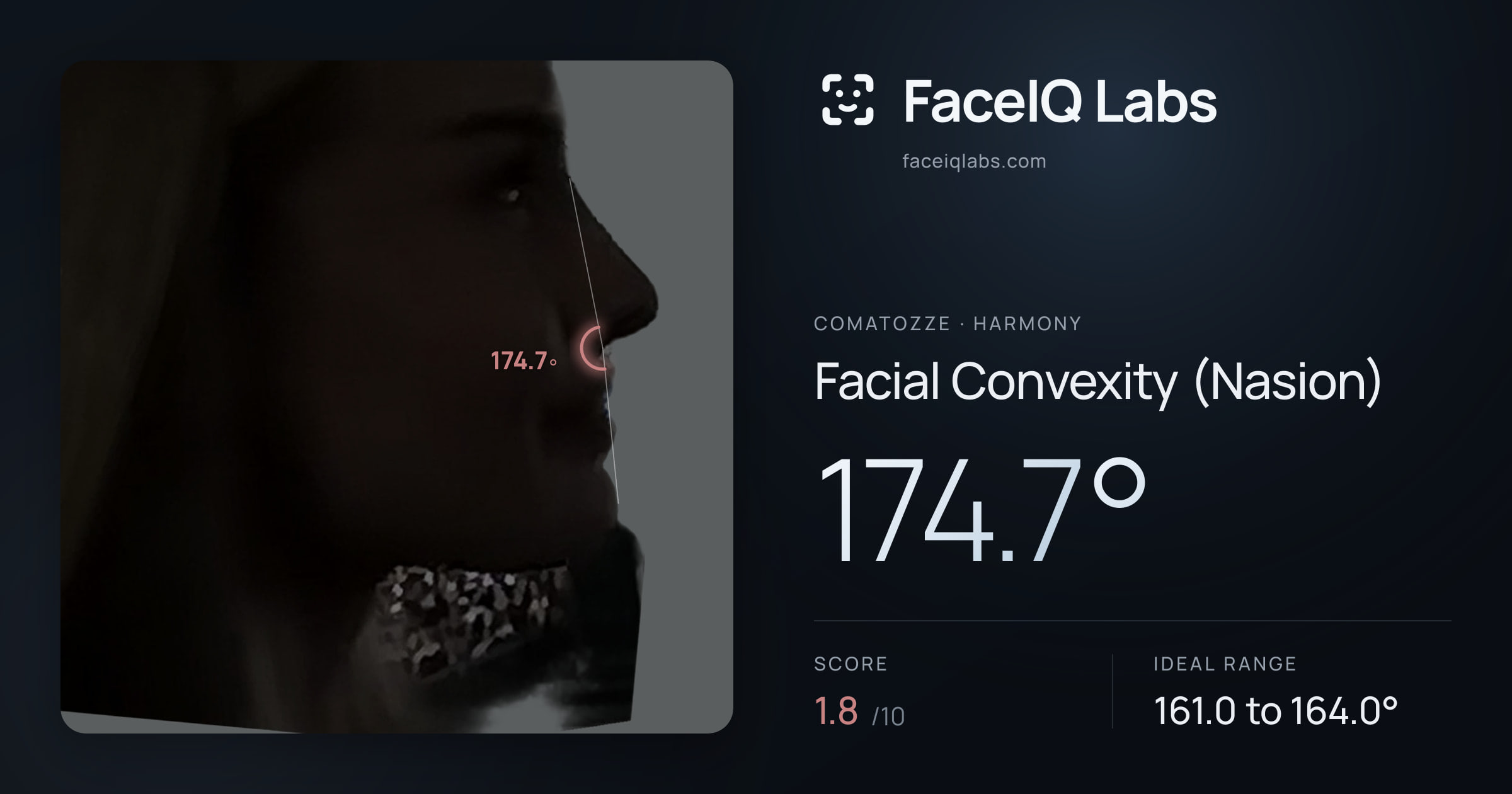 comatozze Facial Convexity (Nasion): 174.7°, drawn on the photo