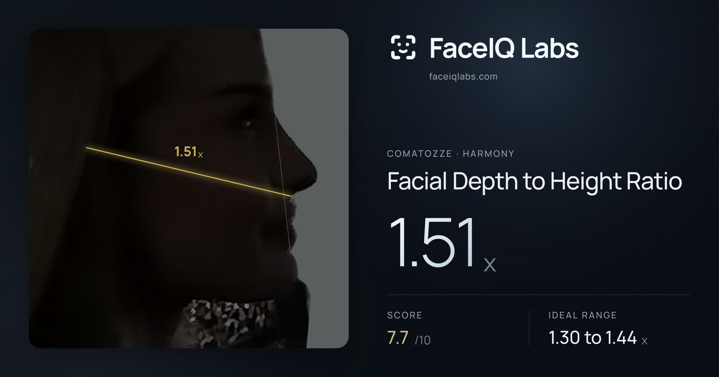 comatozze Facial Depth to Height Ratio: 1.51x, drawn on the photo