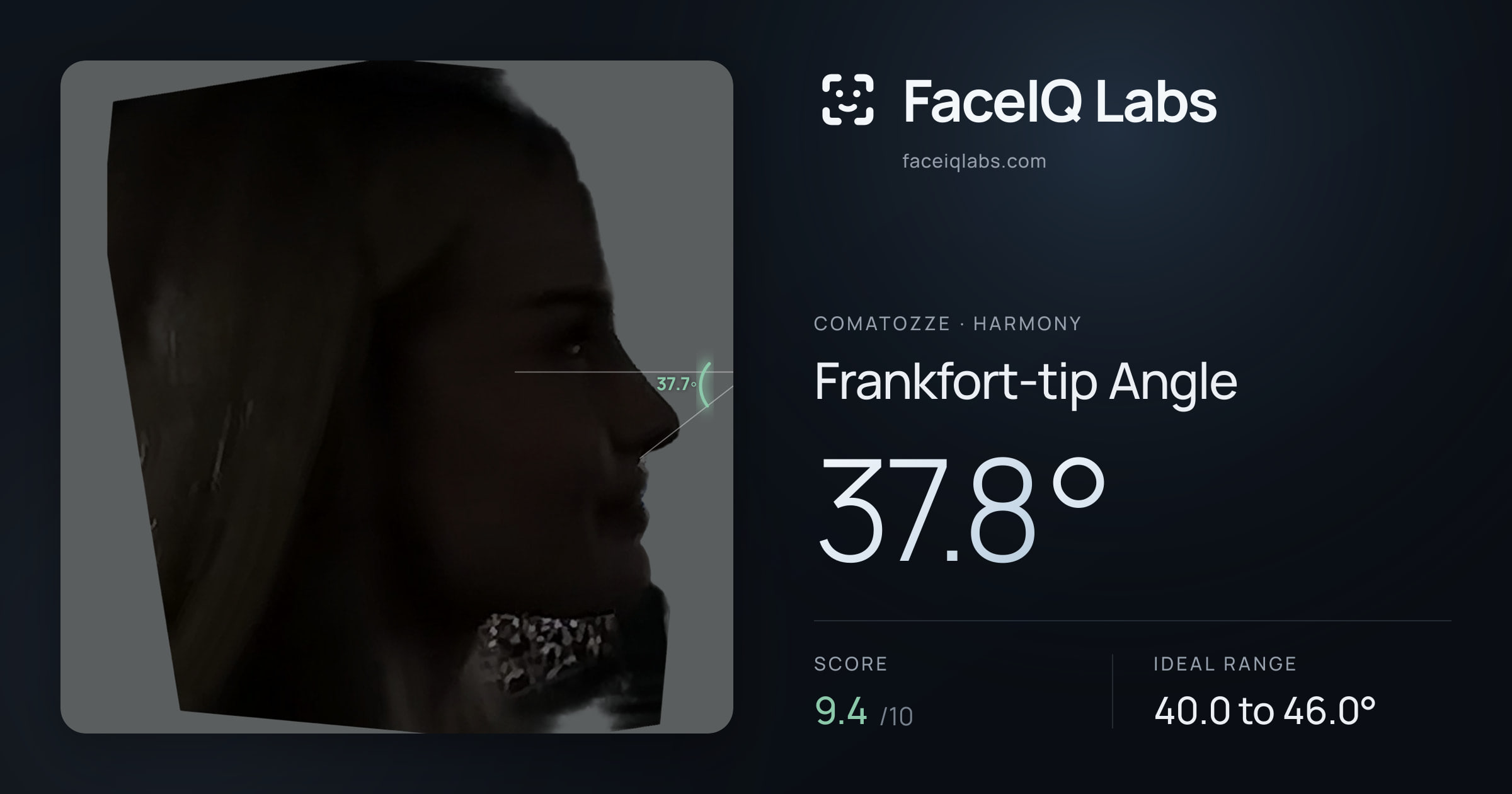 Comatozze Frankfort-tip Angle: 37.8°, drawn on the photo