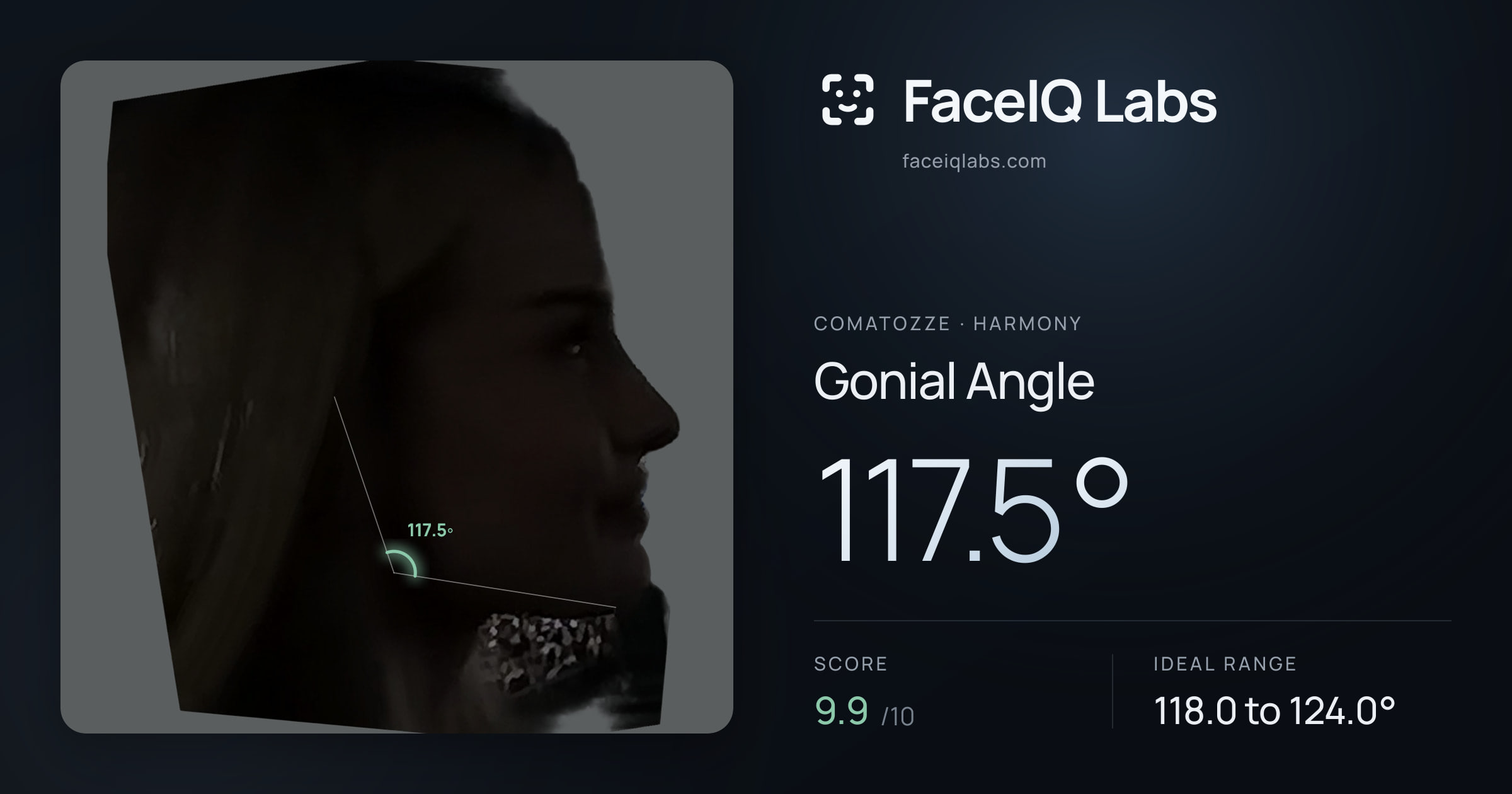 Comatozze Gonial Angle: 117.5°, drawn on the photo