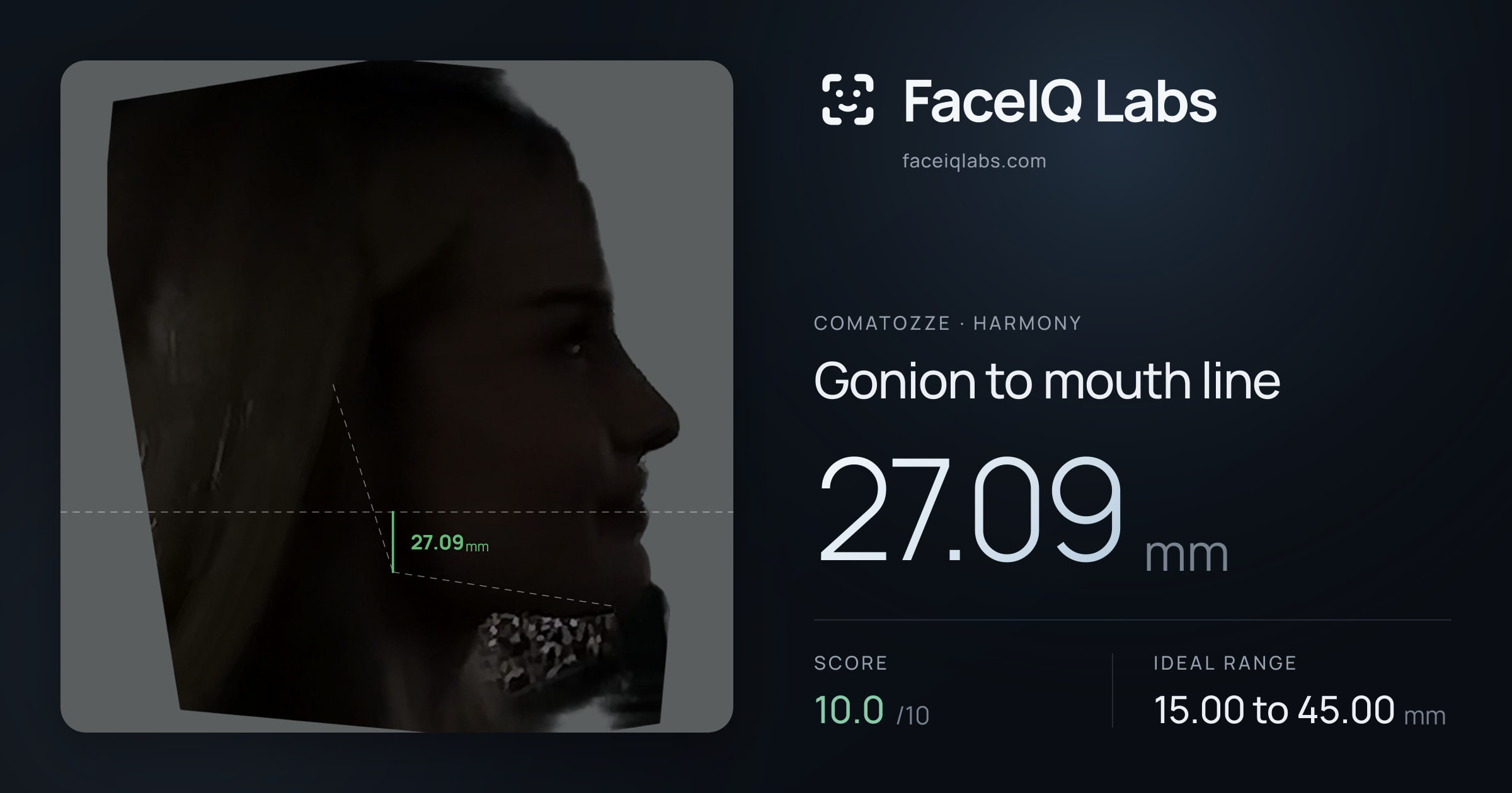 comatozze Gonion to mouth line: 27.09mm, drawn on the photo