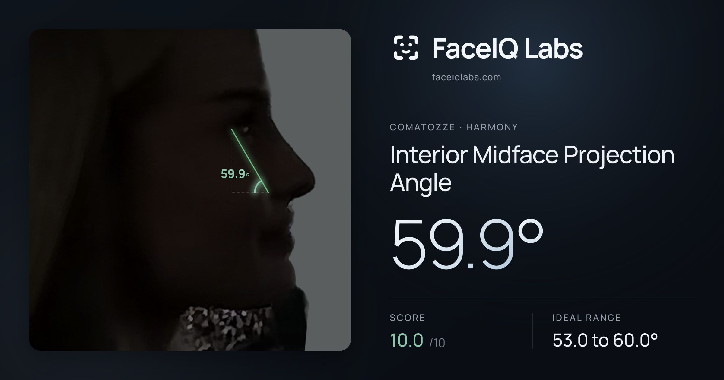 Comatozze Interior Midface Projection Angle: 59.9°, drawn on the photo