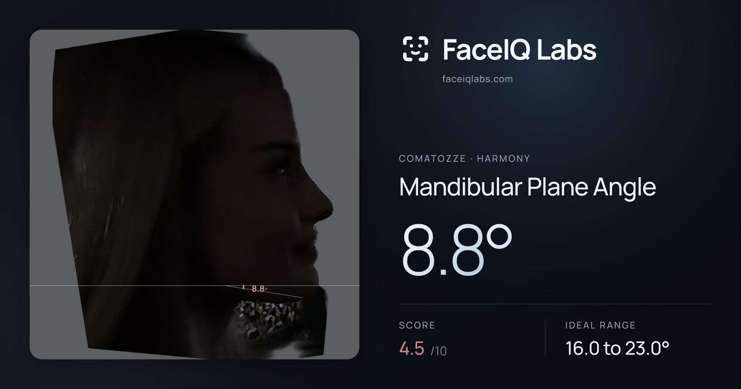comatozze Mandibular Plane Angle: 8.8°, drawn on the photo