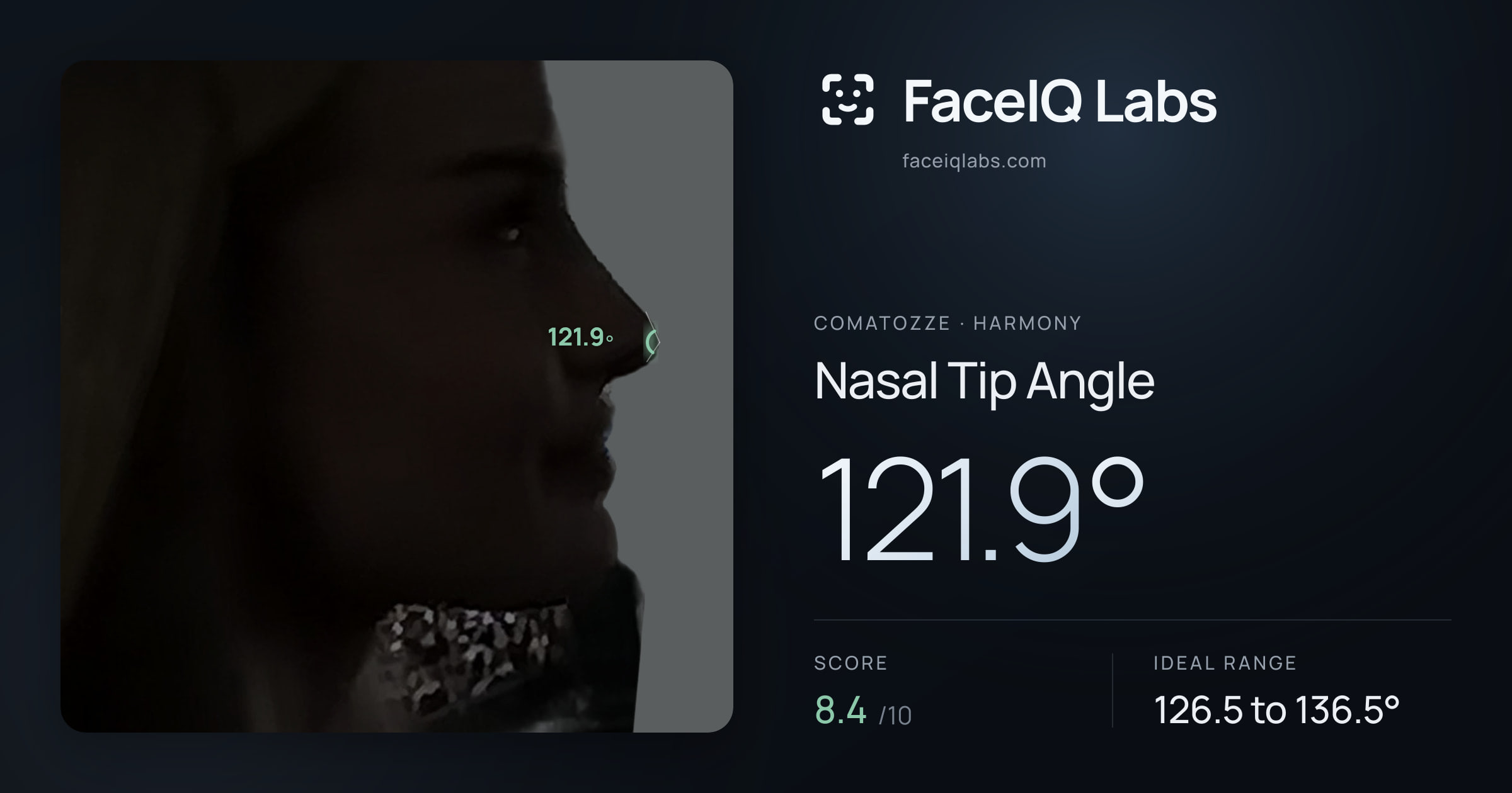 comatozze Nasal Tip Angle: 121.9°, drawn on the photo