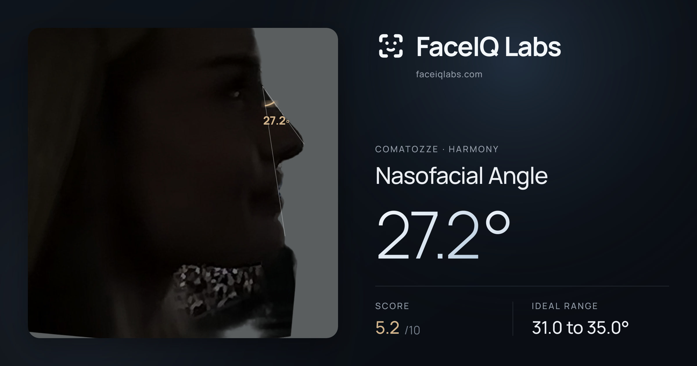 comatozze Nasofacial Angle: 27.2°, drawn on the photo